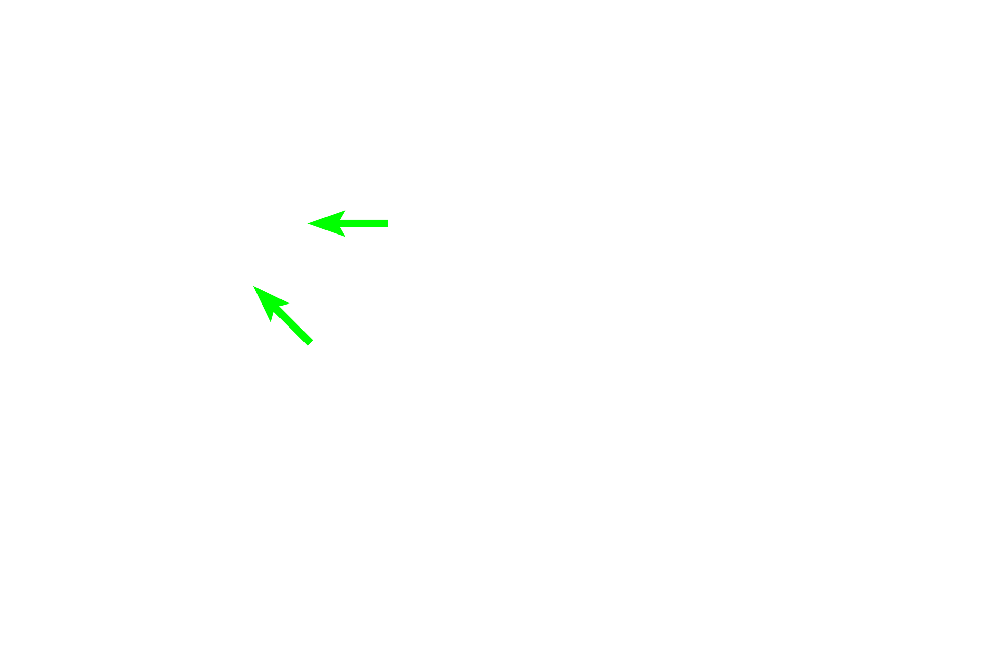 Centromere <p>Anaphase begins as chiasmata break, allowing homologous chromosomes to separate.  Unlike mitosis, sister chromatids remain attached by cohesive proteins at their centromeres, and their kinetochores function together.  Anaphase ends with the segregation of one duplicated chromosome of each homologous pair to each spindle pole.</p>
