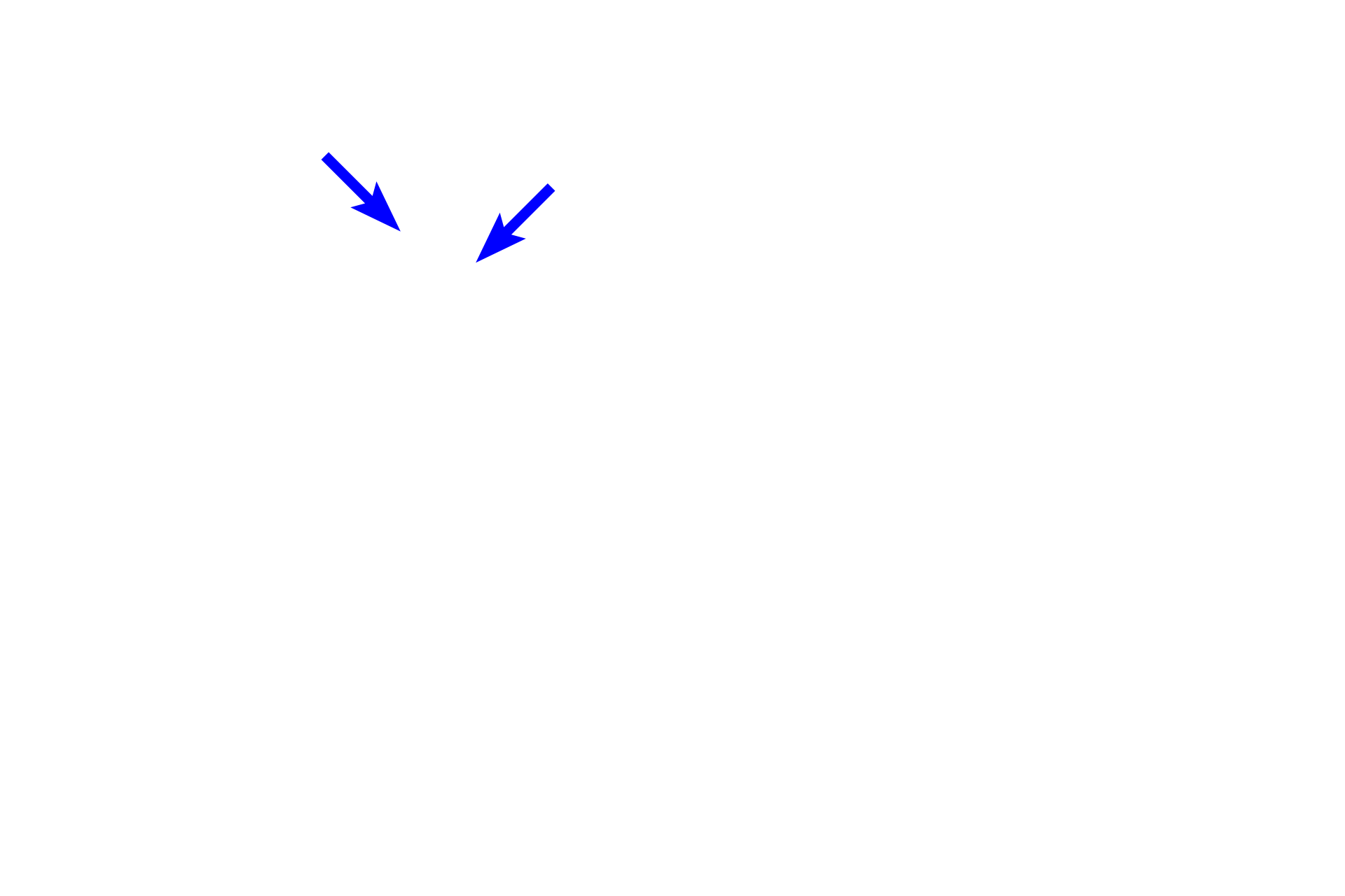 Contractile ring <p>The cleavage furrow, marking the eventual separation site of the daughter cells, is formed by a contractile ring composed of actin and myosin filaments.  Interaction between the filaments tightens the ring and eventually pinches the cell into two daughter cells.</p>

