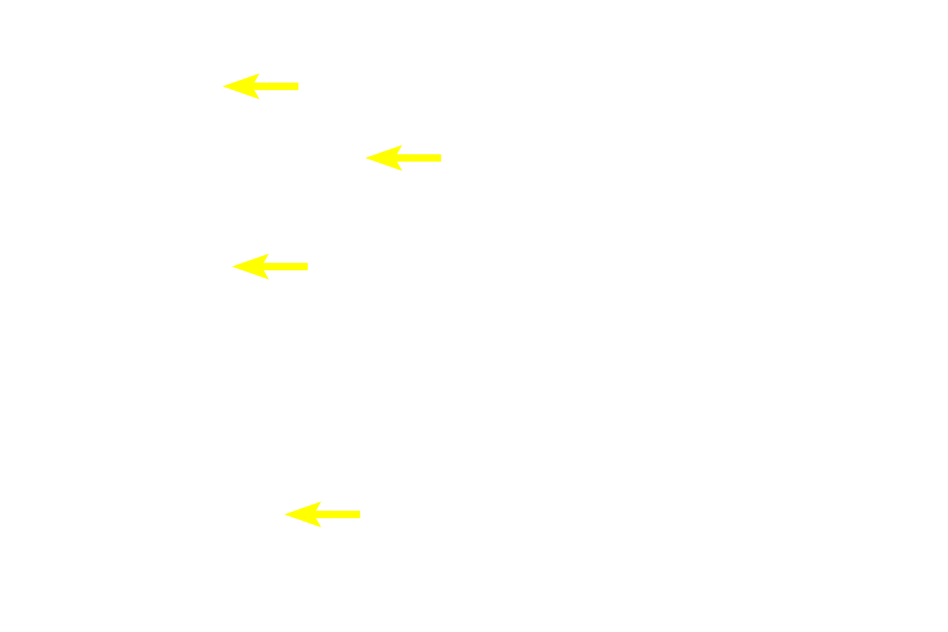 Microfilament bundles <p>The cytoskeleton consists of fibrous structures providing support, movement and intracellular transport.  Components include microfilaments (4-6 nm), intermediate filaments (8-10 nm) and microtubules (20-25 nm).  Microfilaments and microtubules are similar in all cells, while intermediate filaments are heterogeneous and cell-type specific.  800x, 1000x</p>
