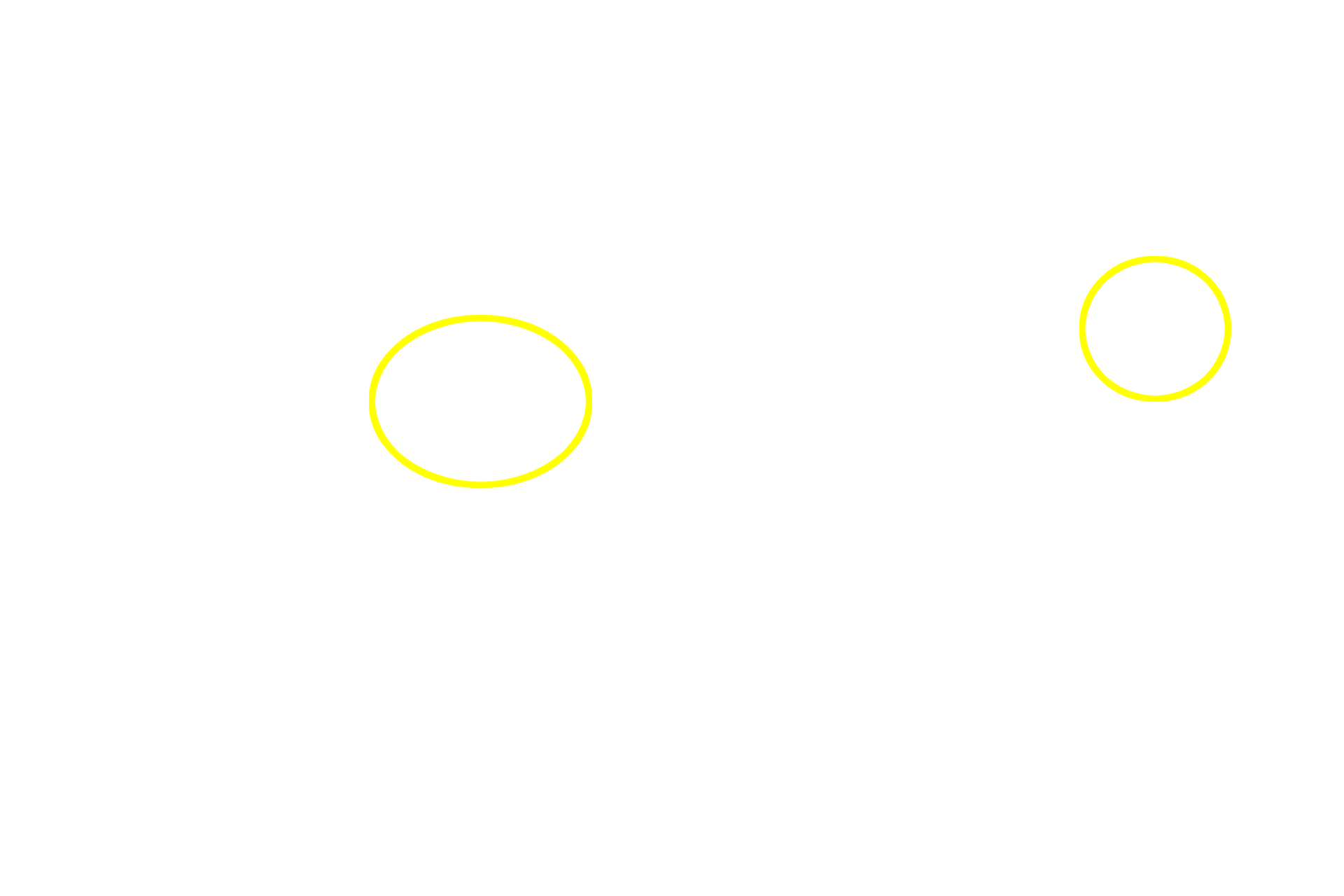 Nuclei (location) <p>Three fibroblasts in culture were stained with fluorescently-labeled phalloidin, which specifically binds to actin, the protein that makes up microfilaments.  In these cells, microfilaments form stress fibers that form a complex network throughout the cytoplasm to provide support for the cell and its processes.  The filaments outline the position of the nucleus.  Microfilaments are also concentrated beneath the plasma membrane.  800x</p>
