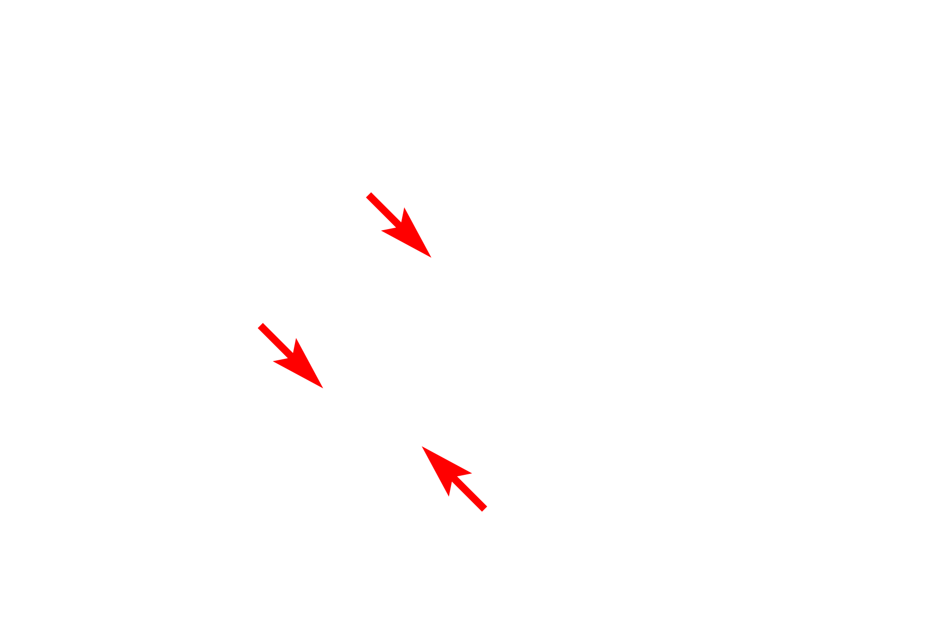  - Ribosomes on RER <p>The RER consists of flattened, interconnected membranous sacs (cisterns) that are continuous with the nuclear envelope.  RER possesses ribosomes for synthesis of proteins for export, membrane insertion and incorporation into lysosomes.  Proteins synthesized by the ribosomes accumulate in the central space of the RER cisterns before being transported to the Golgi apparatus.</p>
