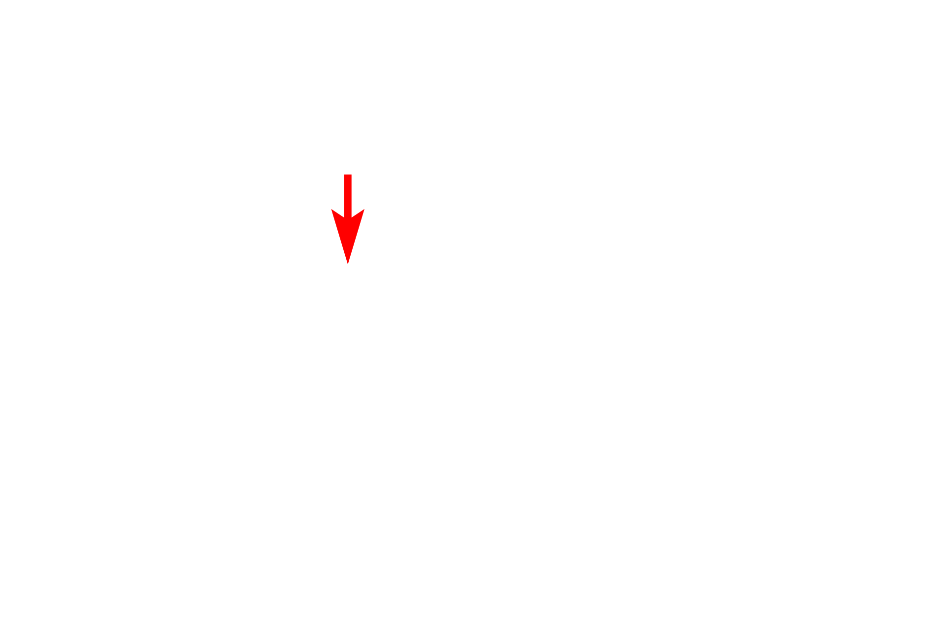 SER > <p>SER consists of branched tubules of unit membranes that are continuous with the RER.  SER lacks ribosomes and functions in lipid synthesis, detoxification and calcium storage.</p>
