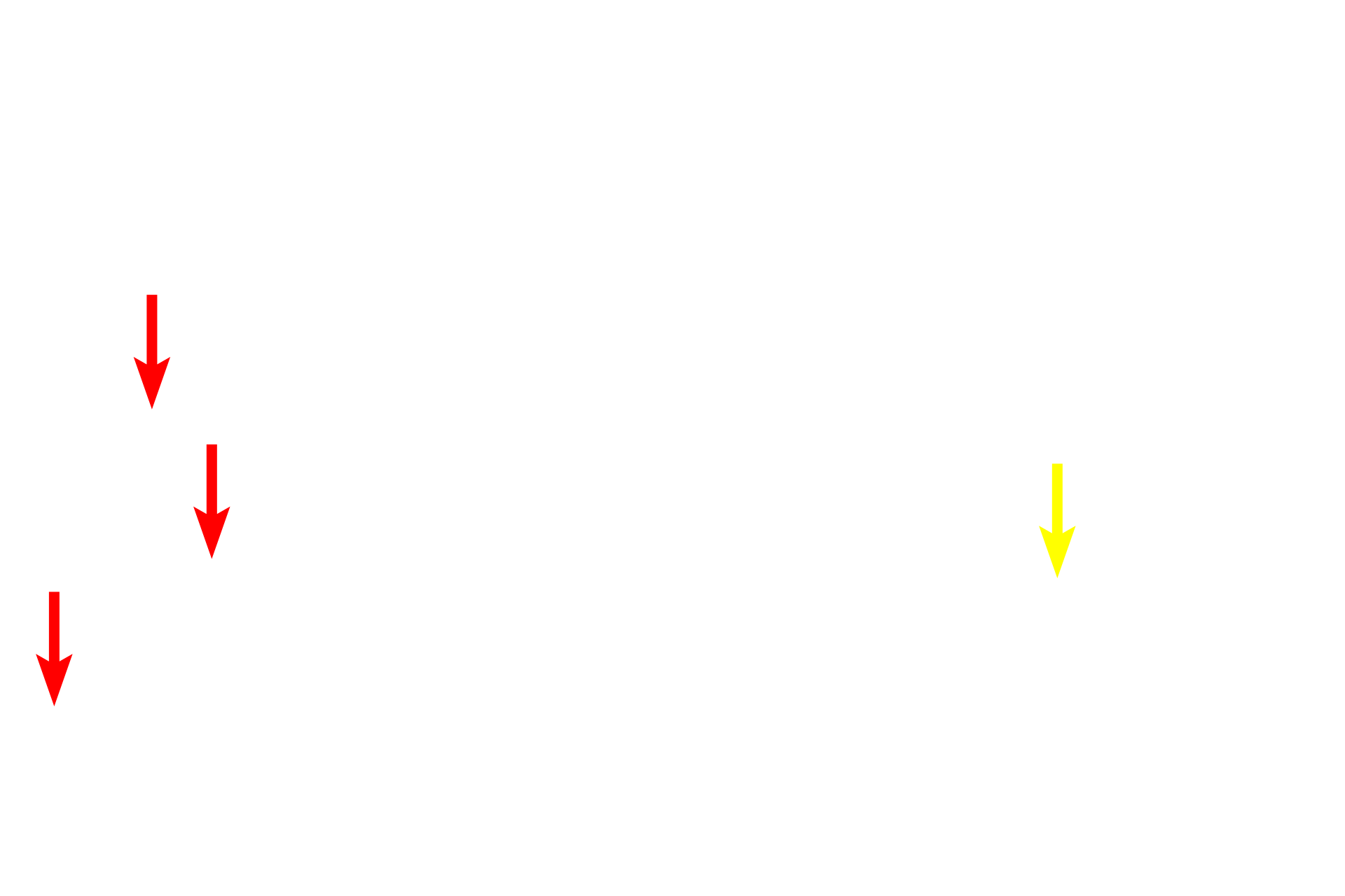 RER > <p>Ribosomes are also present as a component of the rough endoplasmic reticulum (red arrows). This section shows where the RER is continuous with the nuclear envelope (yellow arrow).  15,000x</p>
