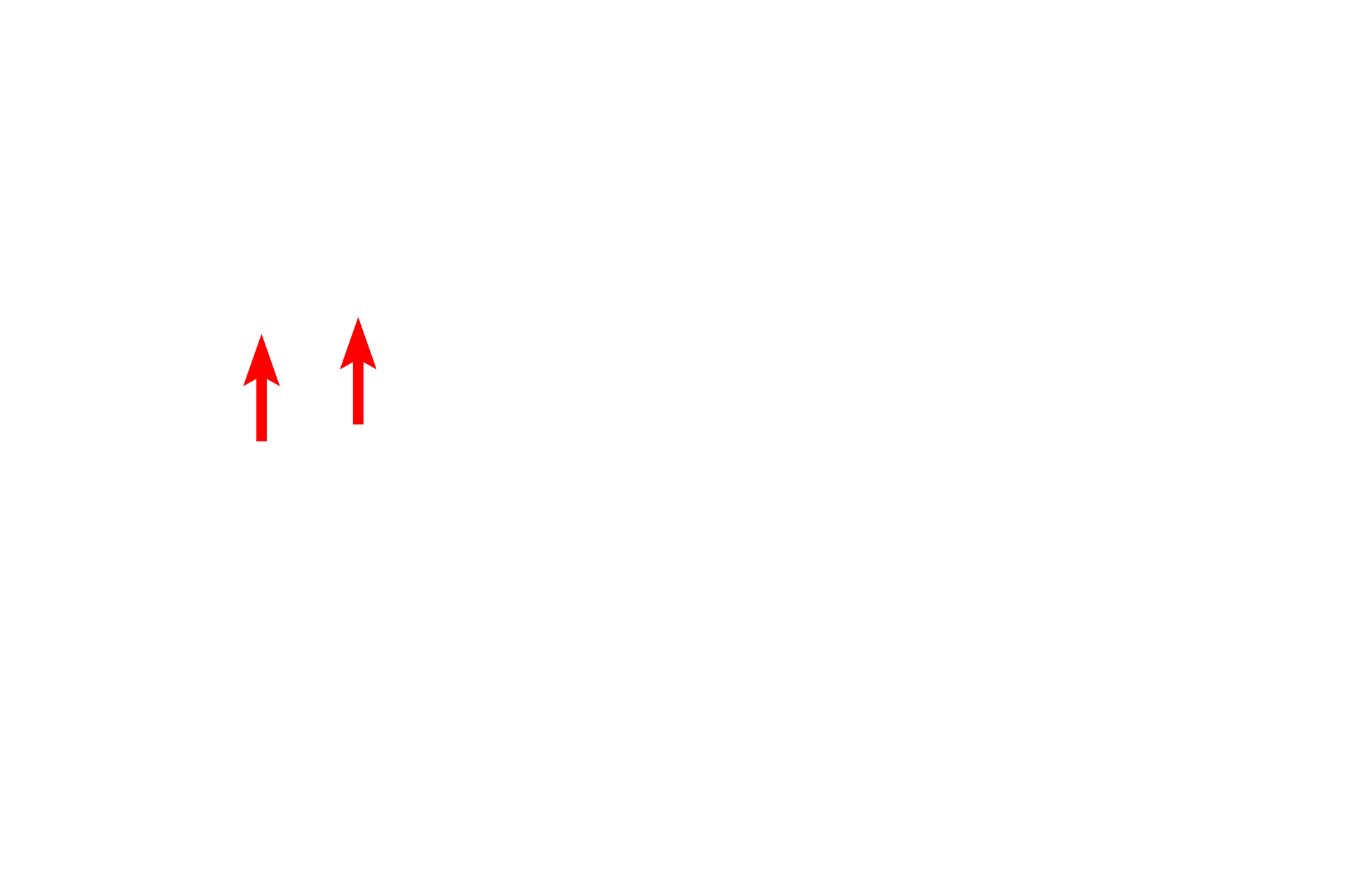 Vesicles, secretory granules <p>Proteins for export and membrane insertion are synthesized by the RER and transferred to the Golgi via transport vesicles.  Transport vesicles fuse with the cis or forming face of the Golgi.  The proteins from the vesicles are post-translationally modified while moving toward the trans or maturing face. There, they are packaged into vesicles and secretory granules for transport to the plasma membrane.</p>
