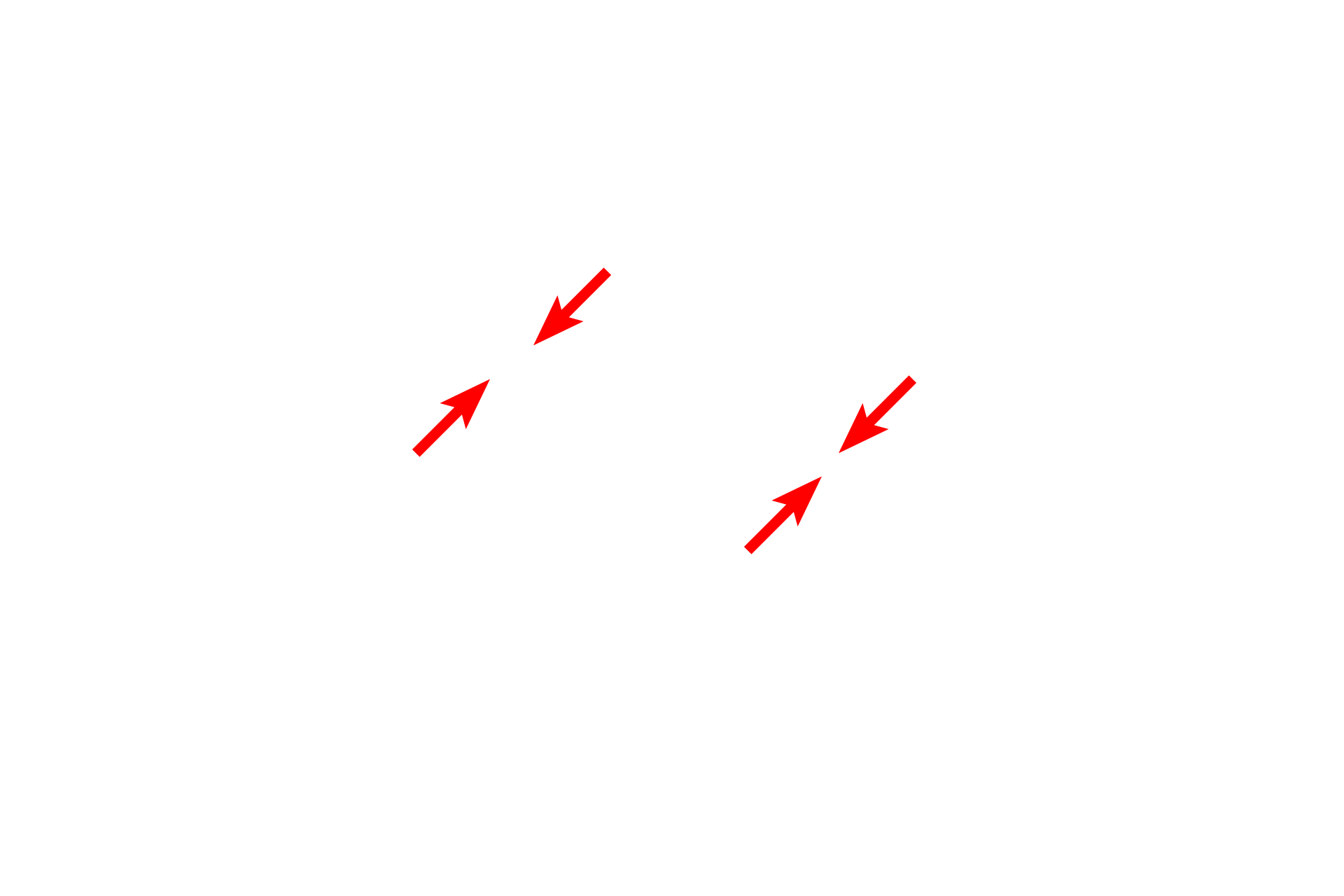 RER <p>Membranes are present at the cell surface and also form membranous intracellular organelles, such as RER, mitochondria and vesicles.  All membranes consist of a phospholipid bilayer composed of cholesterol and protein; integral membrane proteins span the bilayer; peripheral proteins associate with the membrane surface.  Membranes are 8-10 nm in thickness.  45,000x</p>

