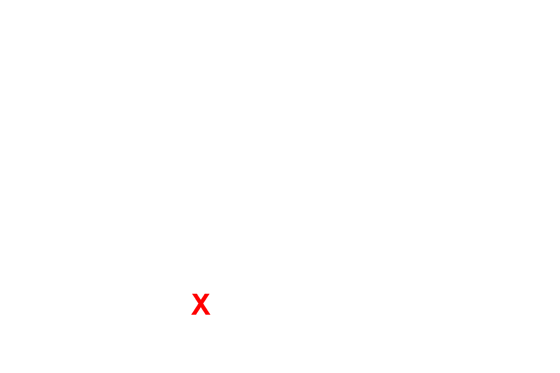 Capillary lumen <p>Movement of materials across the plasma membrane occurs by: (1) simple diffusion for lipid soluble and small uncharged molecules; (2) active or passive transport via membrane transport proteins; and (3) vesicular transport (endocytosis and exocytosis) which requires readily observable morphological changes in the membrane.  Capillary wall  40,000x</p>
