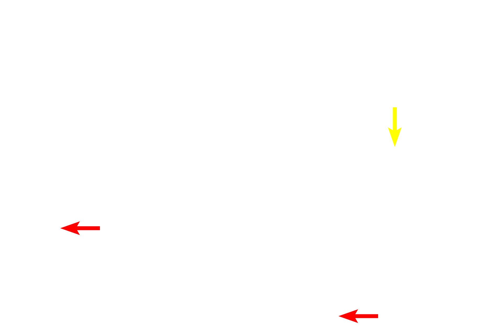 RER > <p>The yellow arrow indicates where the rough endoplasmic reticulum (RER) is continuous with the perinuclear space and outer nuclear envelope.  The red arrows indicated cisterns of RER in the cytoplasm.</p>
