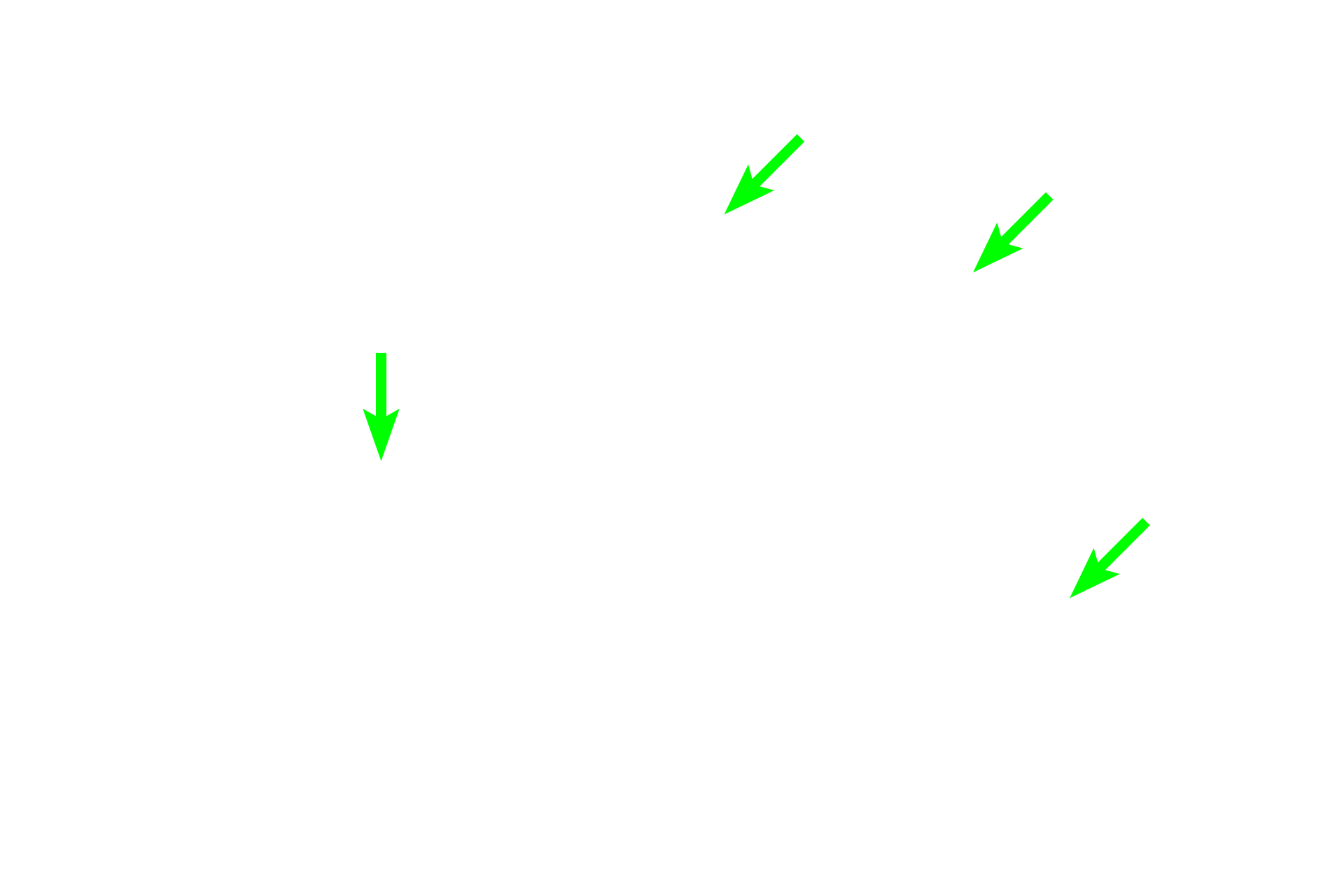 Axons <p>Contraction of skeletal muscle is initiated by depolarization of the sarcolemma at the neuromuscular junction (NMJ) or motor end plate, a specialized synapse between axon terminals and the sarcolemma beneath them. Here, several axons are terminating in neuromuscular junctions on skeletal muscle fibers. The motor neuron plus all the skeletal muscle fibers it innervates is a motor unit. 400x</p>
