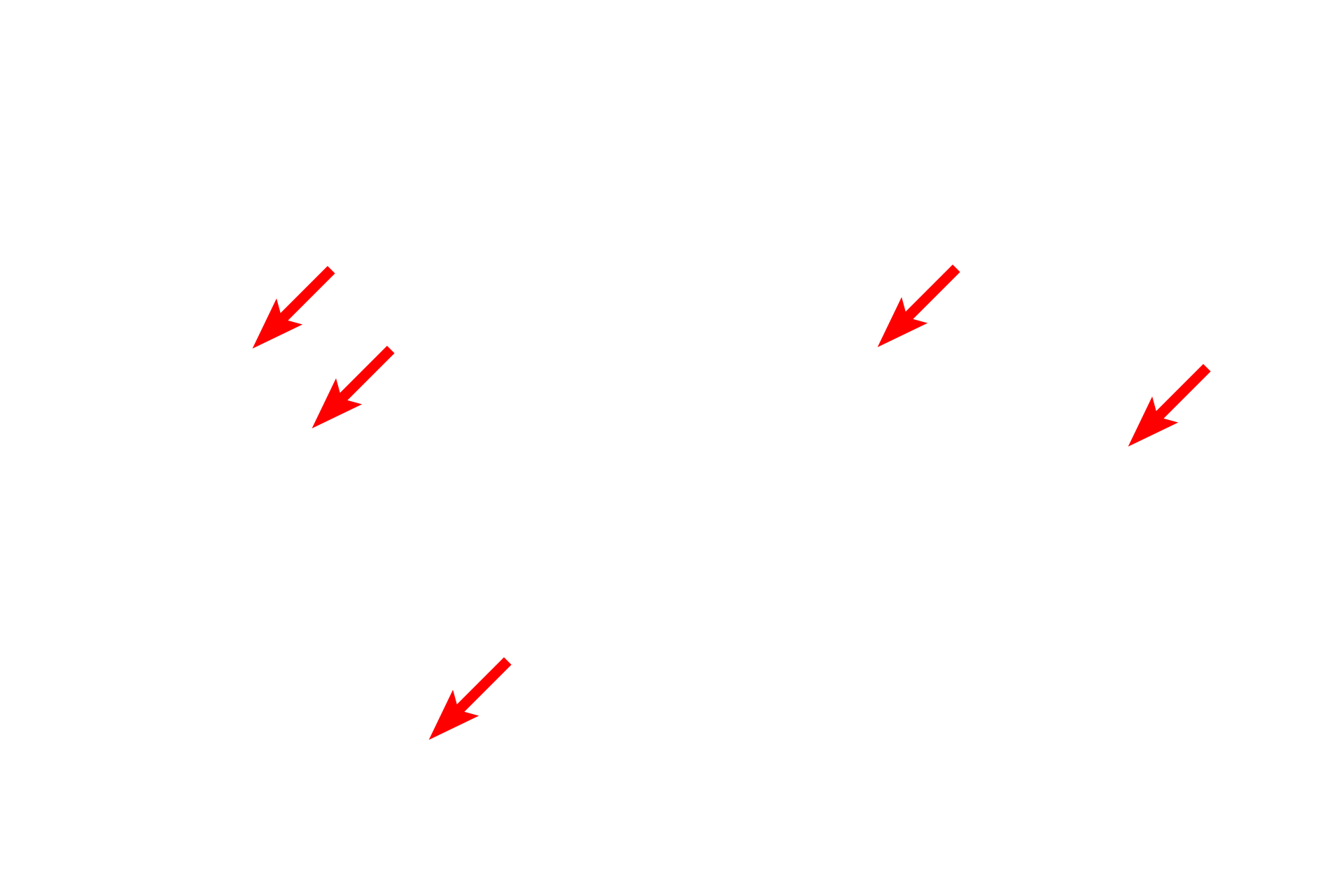 Unmyelinated axons <p>In general, axons with diameters of less than one micron are not myelinated.  Multiple axons indent the surface of a single Schwann cell and are surrounded by a single wrapping of the Schwann cell plasma membrane.  These axons conduct at a slower velocity than their myelinated counterparts.  1000x, 15,000x</p>
