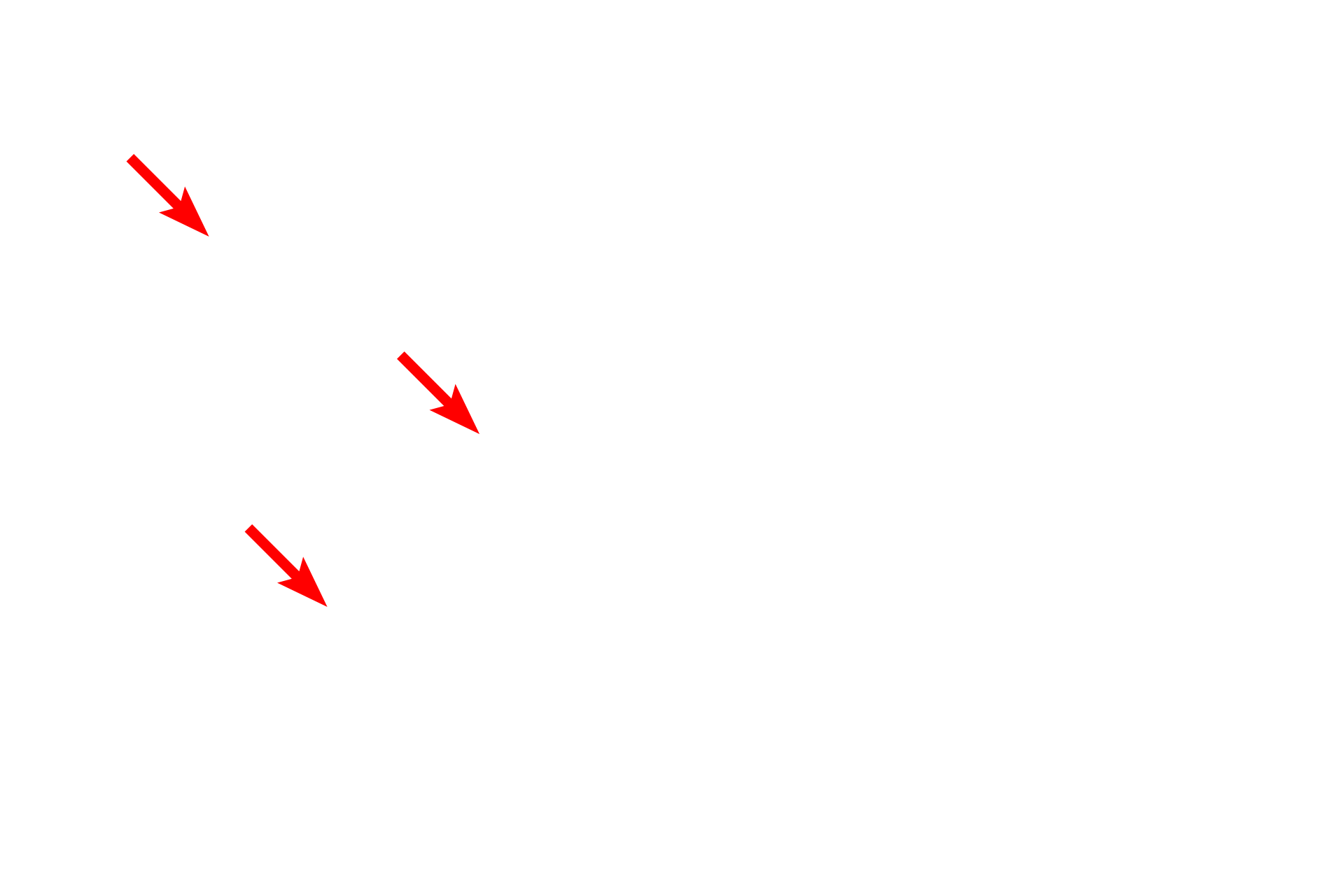 Myelinated axons <p>In general, axons with diameters of less than one micron are not myelinated.  Multiple axons indent the surface of a single Schwann cell and are surrounded by a single wrapping of the Schwann cell plasma membrane.  These axons conduct at a slower velocity than their myelinated counterparts.  1000x, 15,000x</p>
