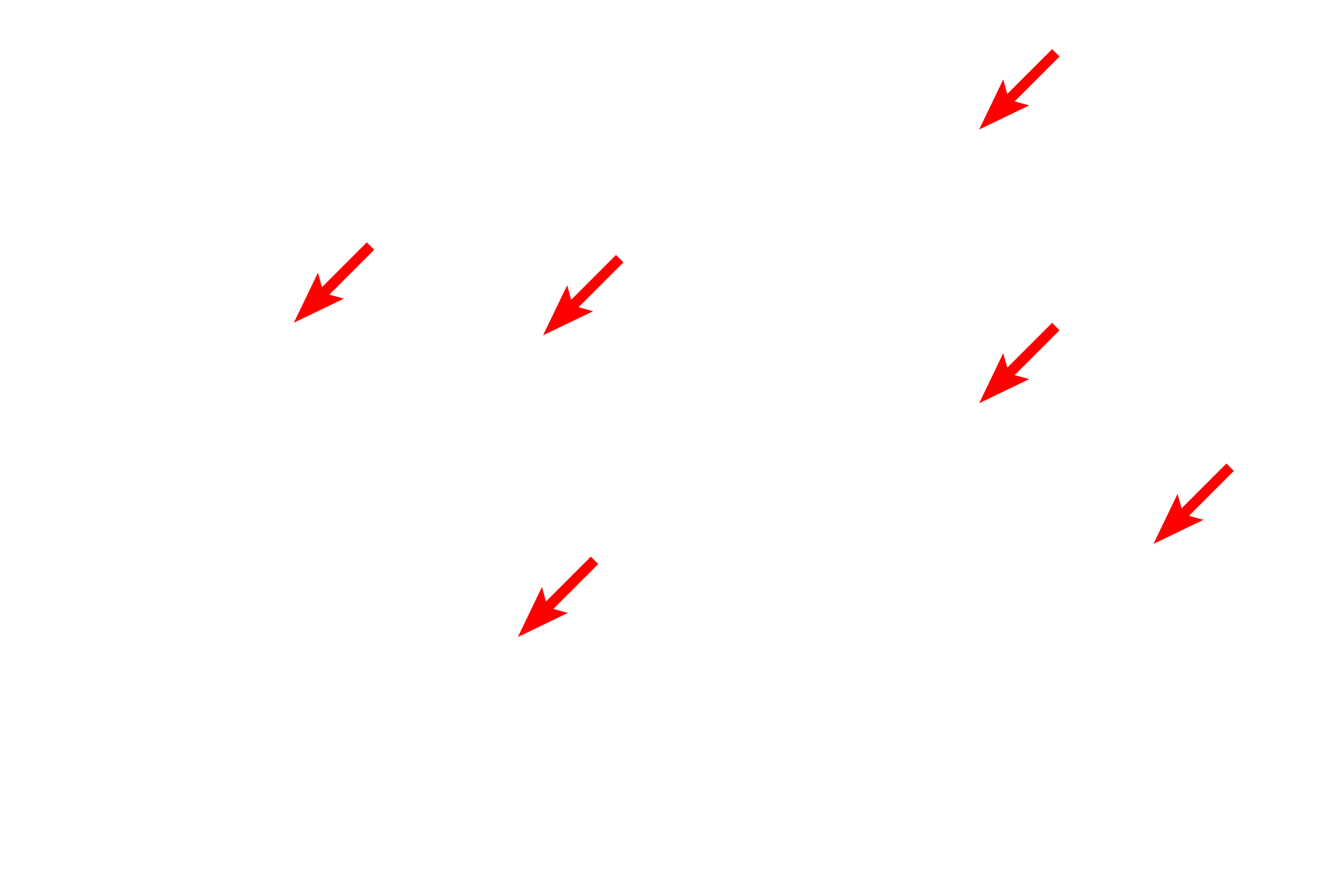 Myelinated axons > <p>Although myelinated axons in the PNS are usually larger than unmyelinated axons, they can vary greatly in their diameters.  In general, larger axons have thicker myelin sheaths.  Here, the myelin is visible as dark bands surrounding each axon.  PNS myelin is produced by Schwann cells, which associate with a single axon and produce a single internode of myelin.</p>
