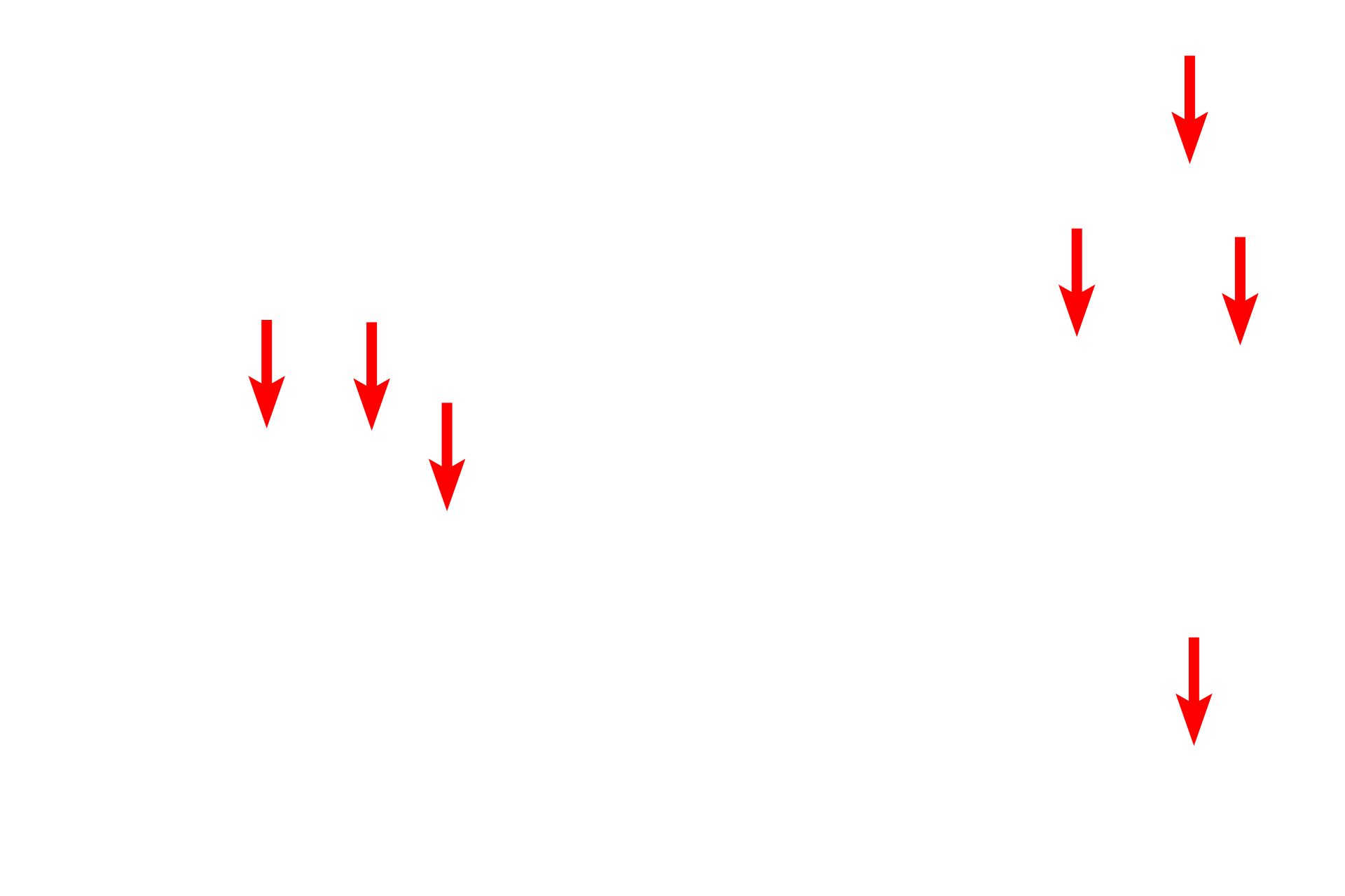 Unmyelinated axons > <p>Unmyelinated axons are generally less than one micron in diameter.  Numerous unmyelinated axons associate with a single Schwann cell, each lying in a longitudinal indentation of the Schwann cell surface.</p>
