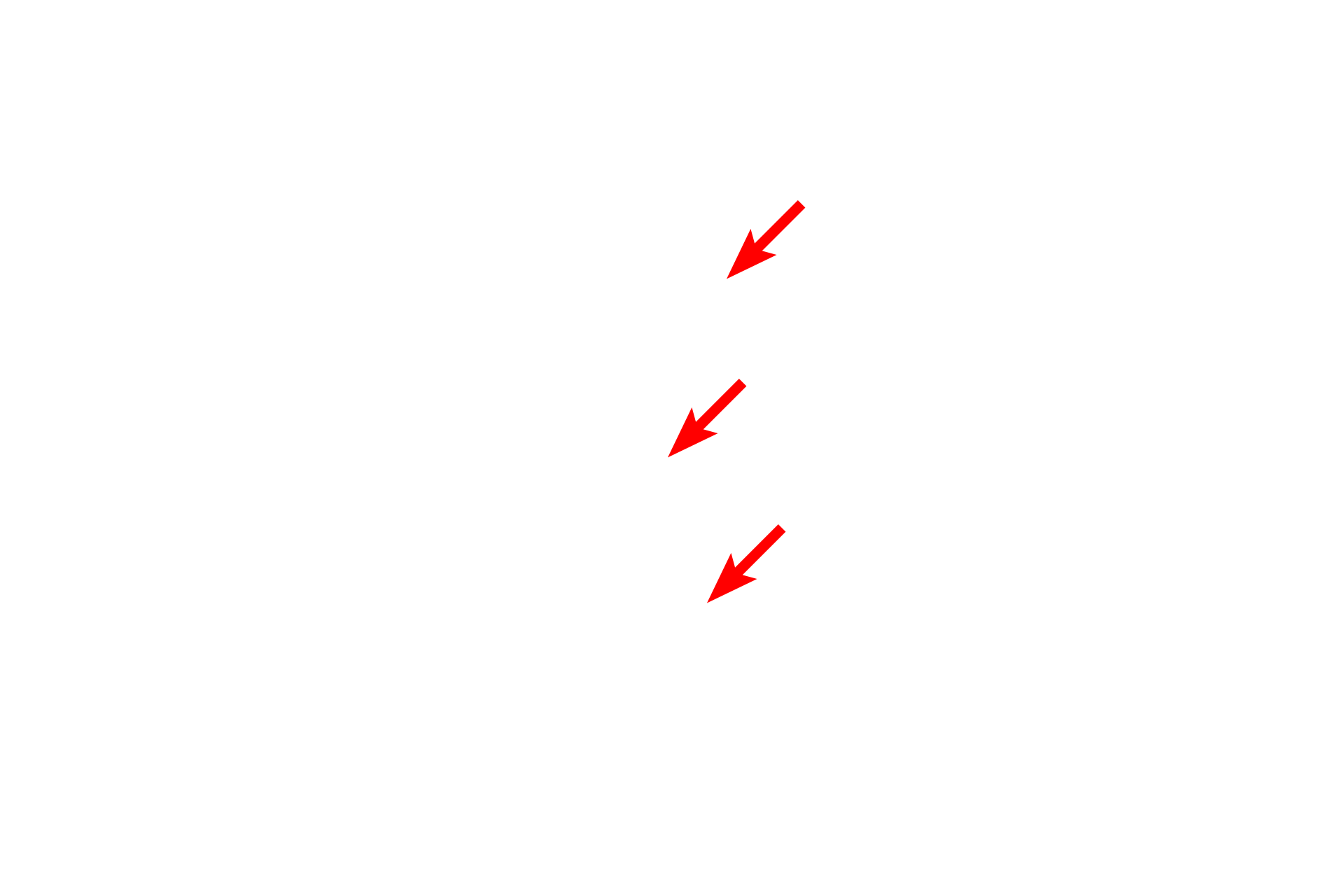 Axons (unmyelinated) <p>Non-myelinating Schwann cells are associated with multiple unmyelinated axons.  These axons indent the plasma membrane of the Schwann cell to become invested by a single Schwann cell membrane.  Myelinated axons, however, are surrounded with many wrappings of the membrane.  40,000x</p>
