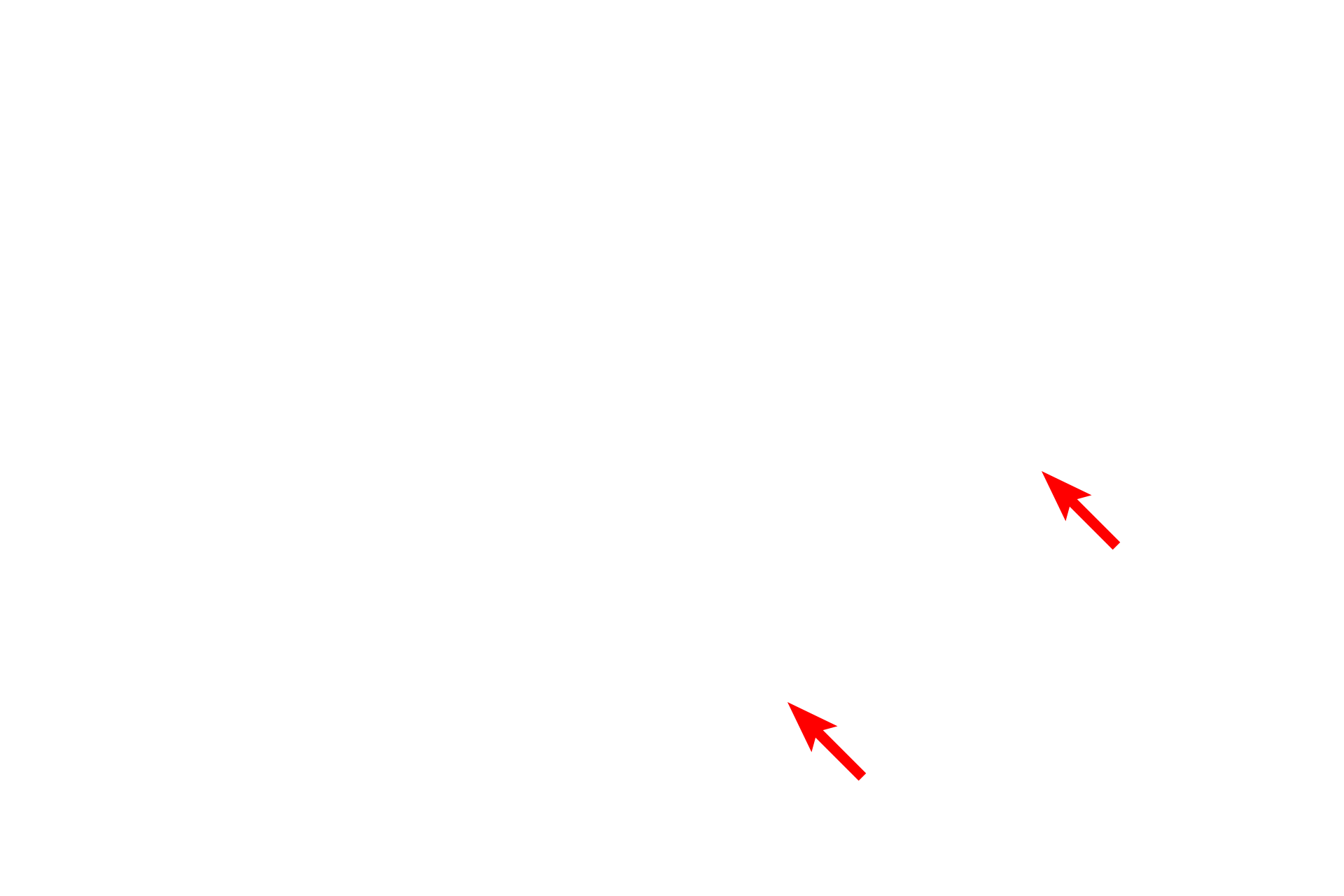 Axon plasma membrane <p>At high magnification the myelin sheath displays the wrappings of the Schwann cell plasma membrane.  Myelin is formed from the concentric wrapping of the Schwann cell plasma membrane, leading to a regular pattern of dark and light lines.  100,000x</p>
