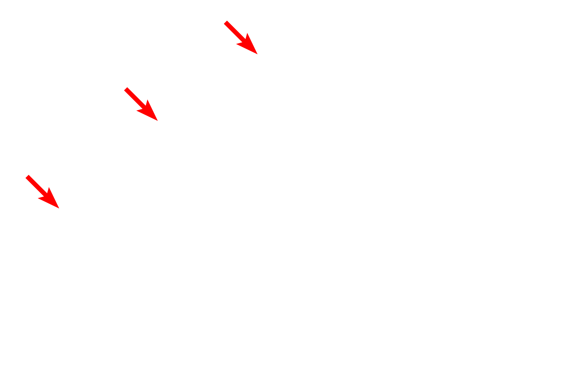 External lamina > <p>Schwann cells secrete an external lamina, which is similar in structure to the basal lamina in epithelial tissues.  The external lamina provides anchorage for the Schwann cell during myelination.  Beyond the external lamina is the endoneurium which consists of delicate collagen fibrils.</p>
