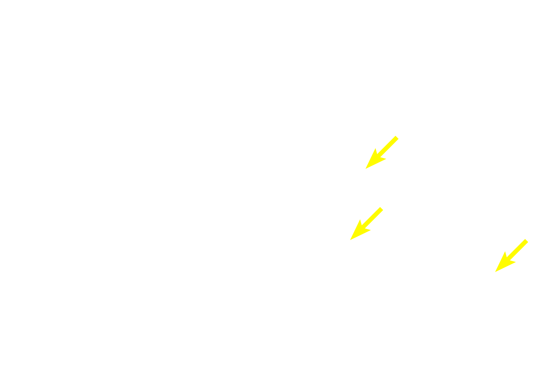 Axons <p>Pseudounipolar neurons, exclusively sensory in function, are found almost entirely in the peripheral nervous system.  The cell body has a single process that divides near the cell body into a peripheral and a central process, both of which resemble an axon.  The peripheral process carries sensory stimuli from the periphery, which by-pass the cell body and continue into the spinal cord.</p>
