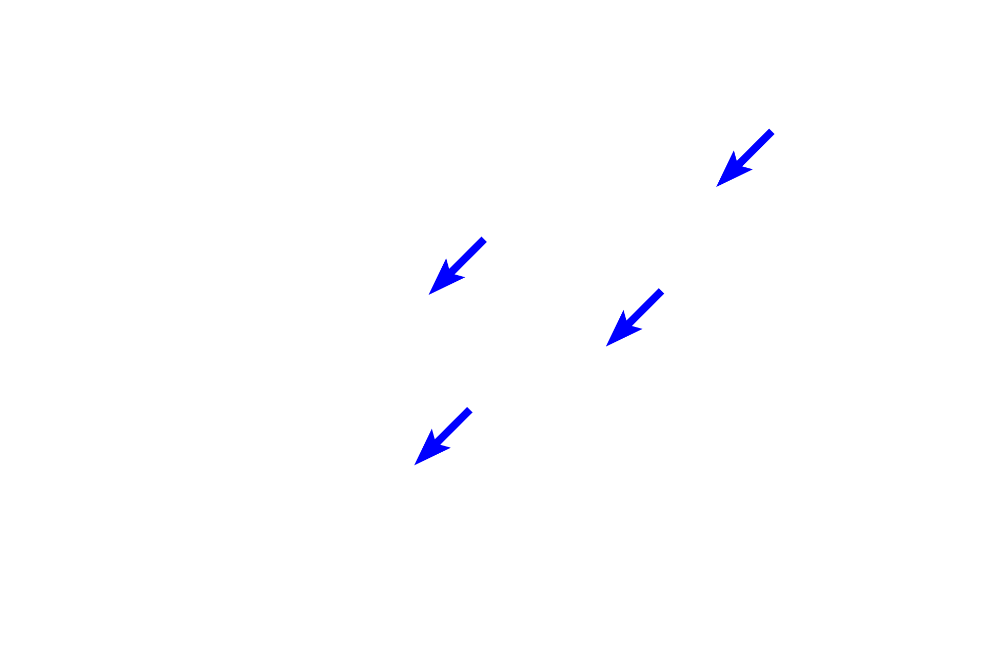Neuronal cell bodies <p>A dendrite originates in the organ of Corti and extends to a bipolar, neuronal cell body located in this spiral ganglion.  From the opposite pole of the cell body, an axon emerges which will join other axons to form the cochlear division of cranial nerve VIII.  Ensheathing Schwann cells can also be seen accompanying both processes.  400x</p>
