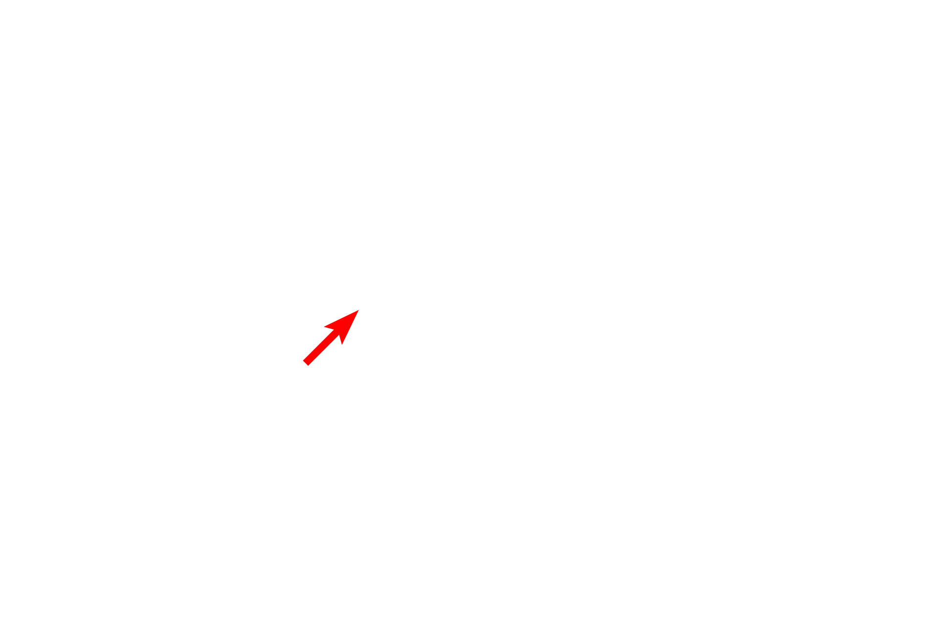 Nucleolus <p>A multipolar neuron shows the abundant Nissl substance in its cytoplasm, as well as a characteristically large, euchromatic nucleus and prominent nucleolus.  Two Nissl-containing dendrites extend from the cell body.  Nuclei of astrocytes and oligodendrocytes, as well as myelinated axons, are also present.  Toluidine blue stain  1000x</p>
