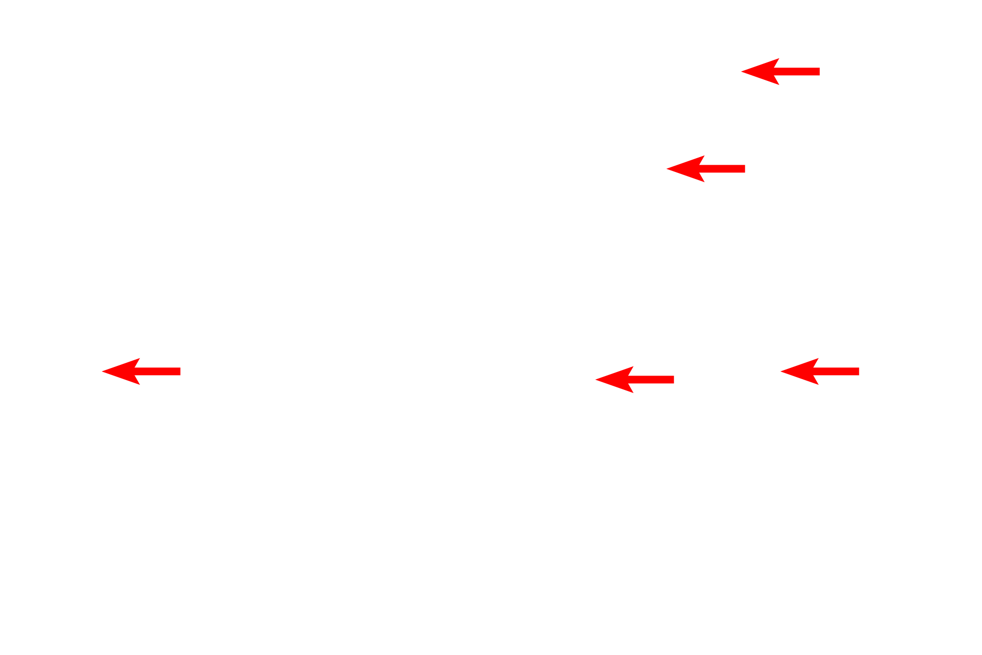 Myelinated axons <p>A multipolar neuron shows the abundant Nissl substance in its cytoplasm, as well as a characteristically large, euchromatic nucleus and prominent nucleolus.  Two Nissl-containing dendrites extend from the cell body.  Nuclei of astrocytes and oligodendrocytes, as well as myelinated axons, are also present.  Toluidine blue stain  1000x</p>
