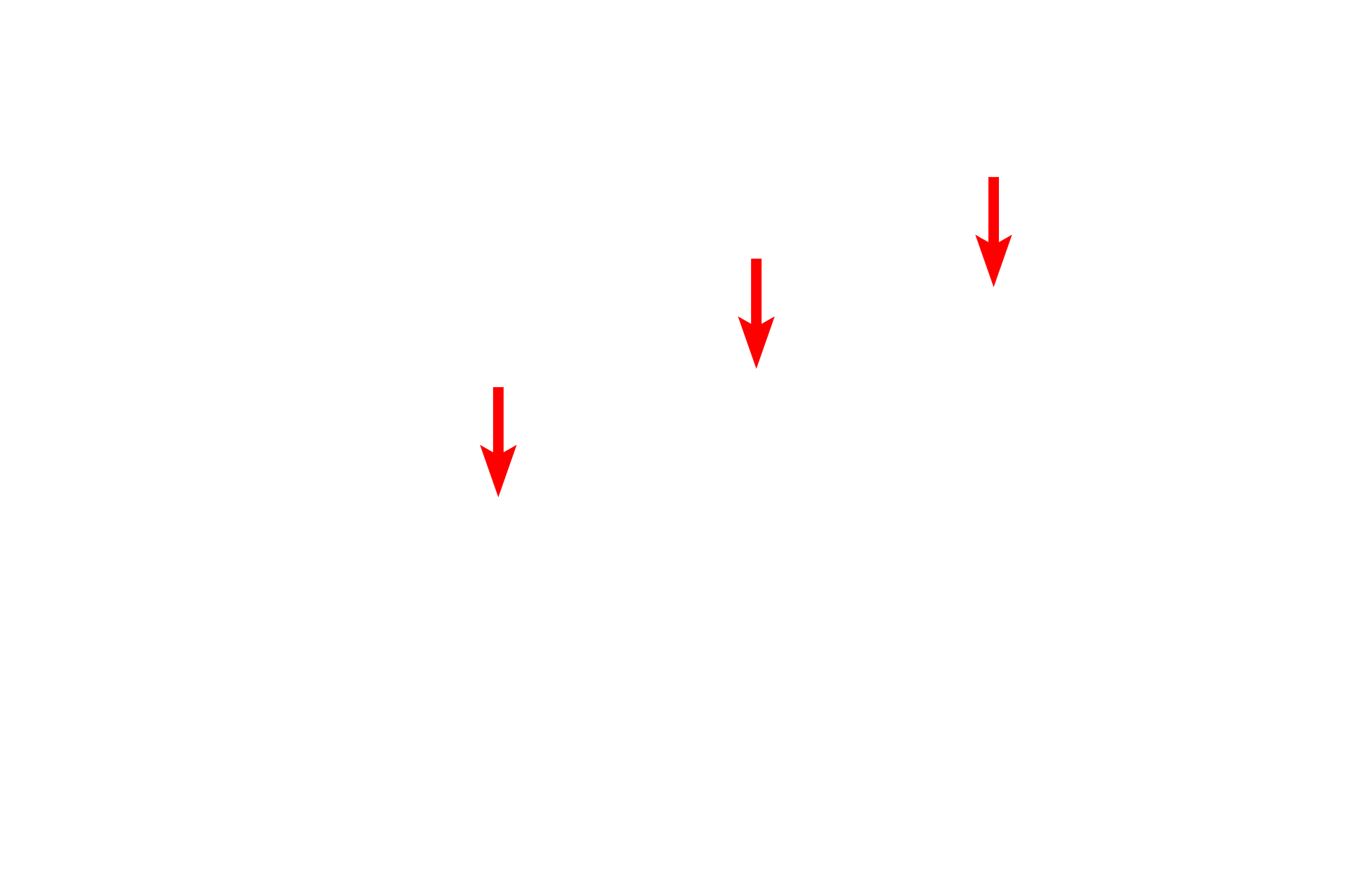 Nucleus <p>All epithelia rest on a basement membrane, which consists of two components, the basal lamina, secreted by epithelial cells, and a reticular lamina, secreted by fibroblasts in the underlying connective tissue.  The basal lamina is, in turn, subdivided into lamina lucida and lamina densa.  Additional studies have shown that the presence of the lamina lucida results from a fixation-shrinkage artifact of the tissue.  The clear space does not exist in life and thus the lamina densa lies directly adjacent to the plasma membrane.  Serosa  15,000x</p>
