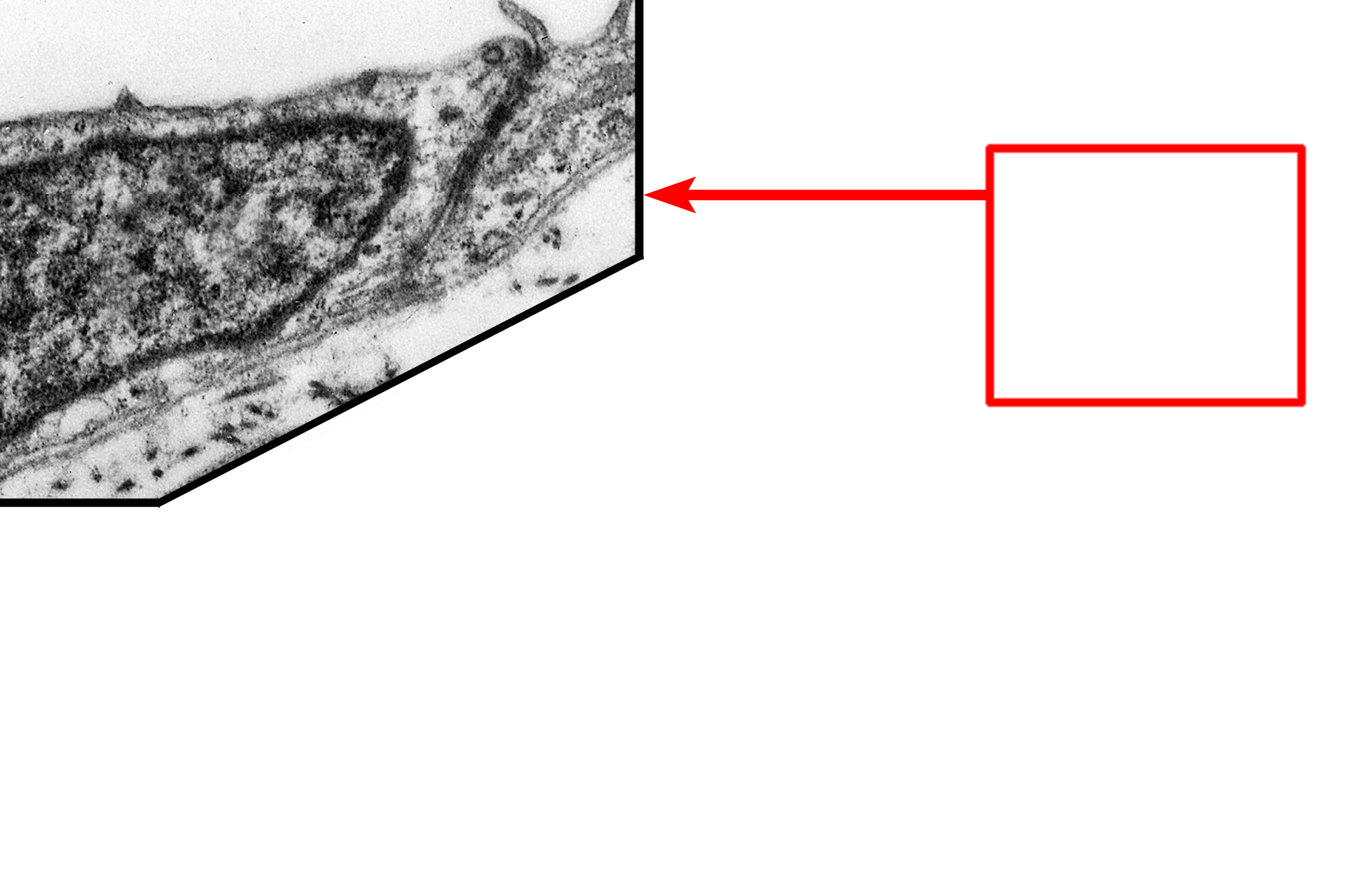 Inset (higher magnification) <p>All epithelia rest on a basement membrane, which consists of two components, the basal lamina, secreted by epithelial cells, and a reticular lamina, secreted by fibroblasts in the underlying connective tissue.  The basal lamina is, in turn, subdivided into lamina lucida and lamina densa.  Serosa  15,000x</p>
