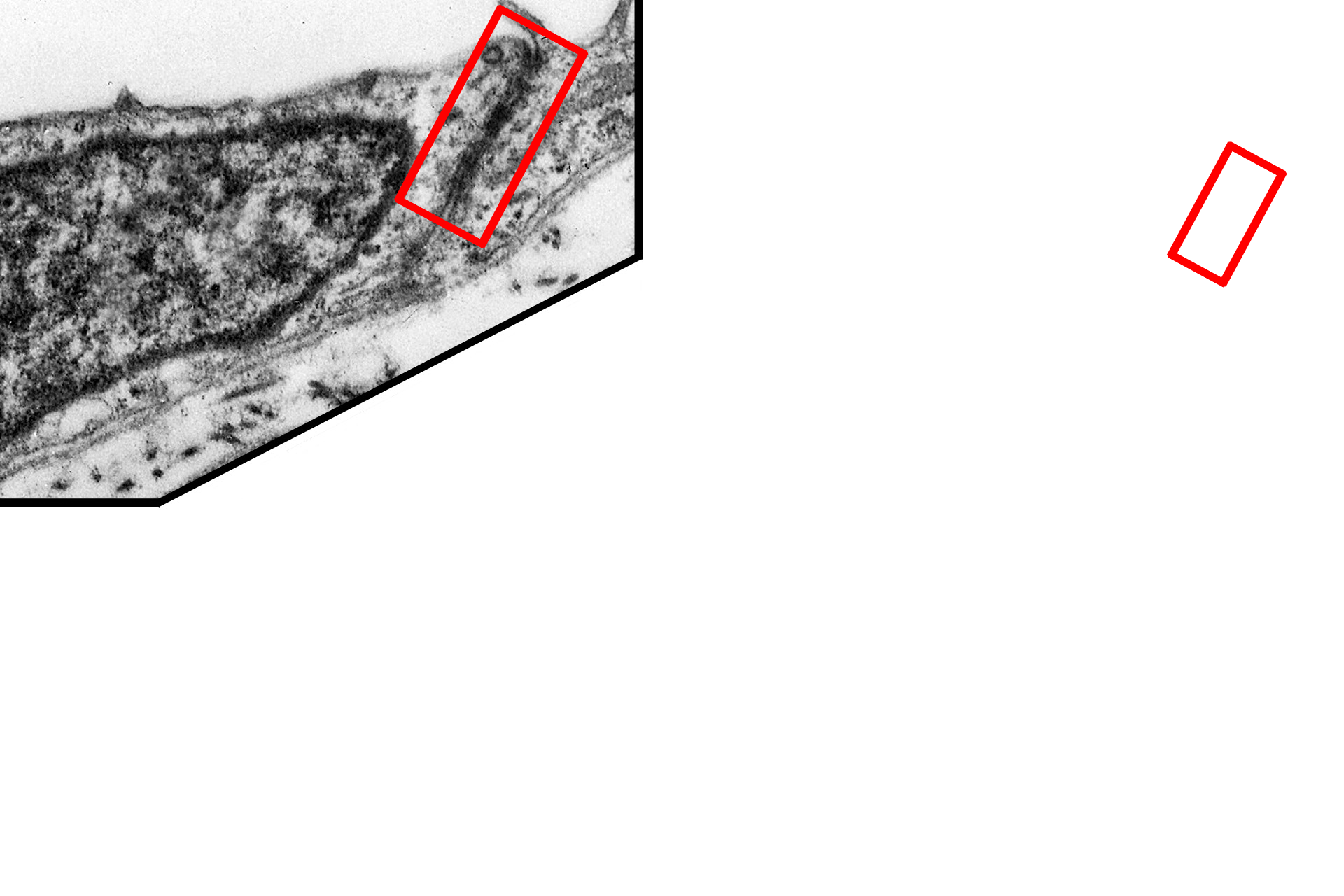Junctional complex <p>All epithelia rest on a basement membrane, which consists of two components, the basal lamina, secreted by epithelial cells, and a reticular lamina, secreted by fibroblasts in the underlying connective tissue.  The basal lamina is, in turn, subdivided into lamina lucida and lamina densa.  Serosa  15,000x</p>
