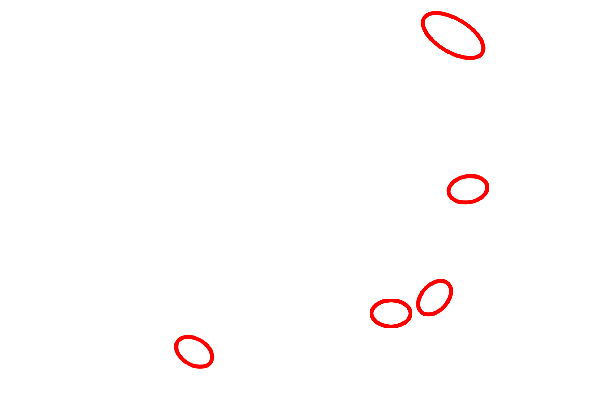 Hemidesmosomes <p>Hemidesmosomes are prominent in the basal layer of the epidermis.  Structurally, they consist of one-half of a desmosome and serve to anchor an epithelium to its underlying basal lamina.  The associated keratin intermediate filaments insert into the attachment plaques.  Transmembrane proteins extend from the plaque into the basal lamina to provide attachment.  30,000x</p>
