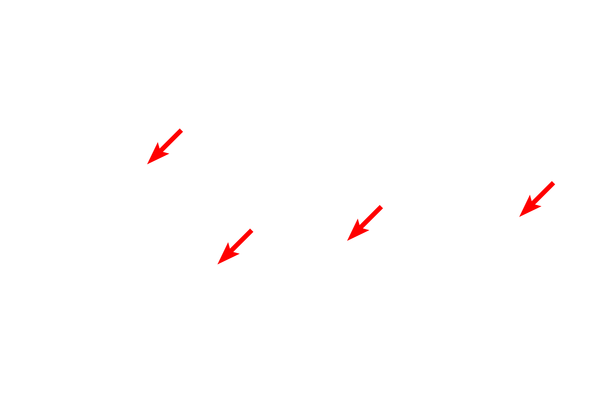  - Attachment plaques <p>This electron micrograph of human skin shows the details of the basement membrane of an epithelium that is exposed to significant physical force. Numerous hemidesmosomes, which anchor the basal surface of the epithelial cells to the basal lamina, are present. Associated keratin filaments insert into the attachment plaques of the hemidesmosomes. Also visible are prominent anchoring fibrils that secure the epithelium to the underlying connective tissue. 45,000x</p>
