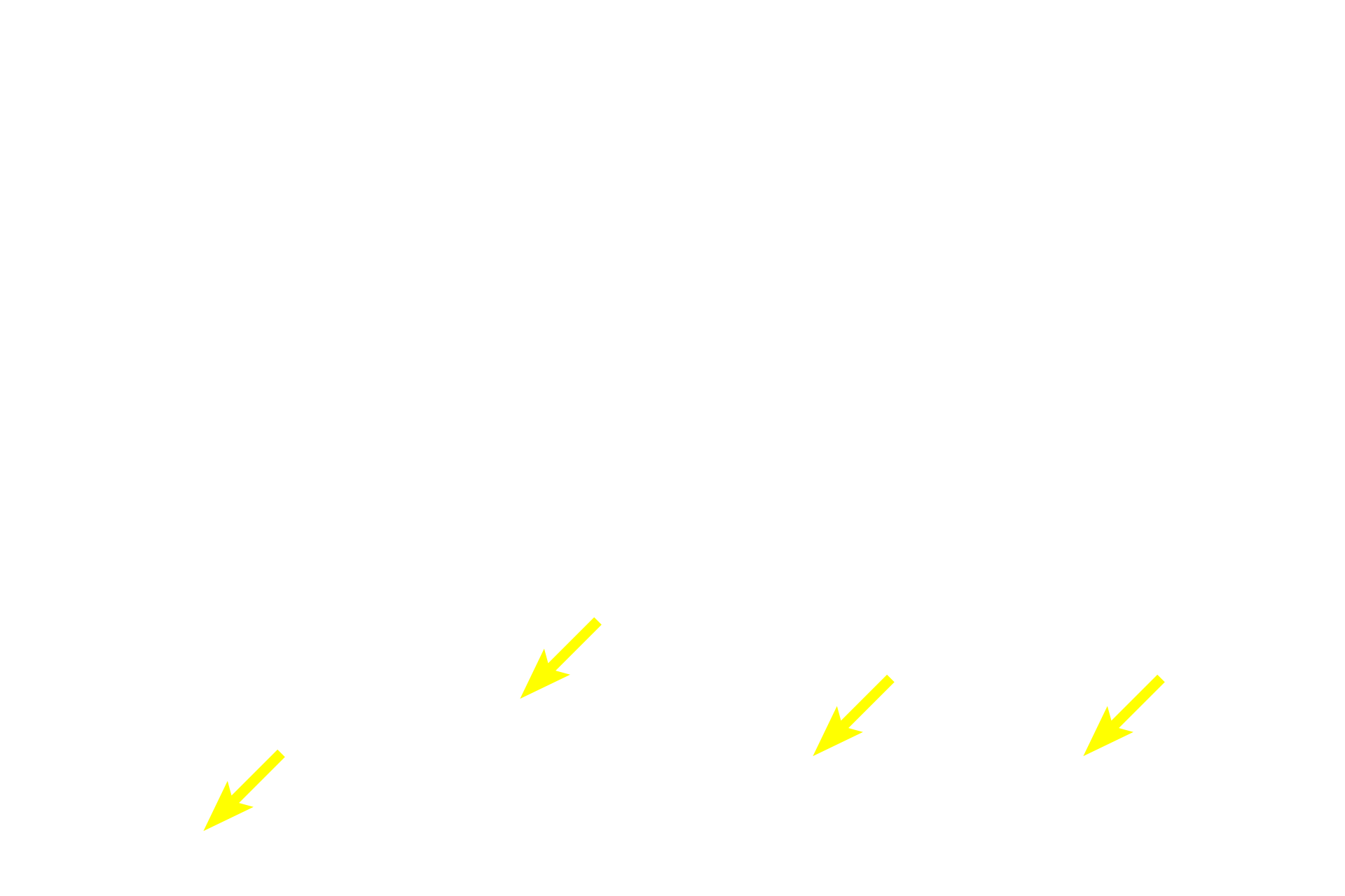  - Basal layer cells <p>Stratified epithelia have multiple layers and are further classified by the shape of the cells at the surface.  In stratified squamous epithelia, cells flatten as they are pushed from basal to surface layers.  Surface cells are living, with visible nuclei.  A layer of keratin does not form and the epithelium remains moist.  Esophagus  400x</p>
