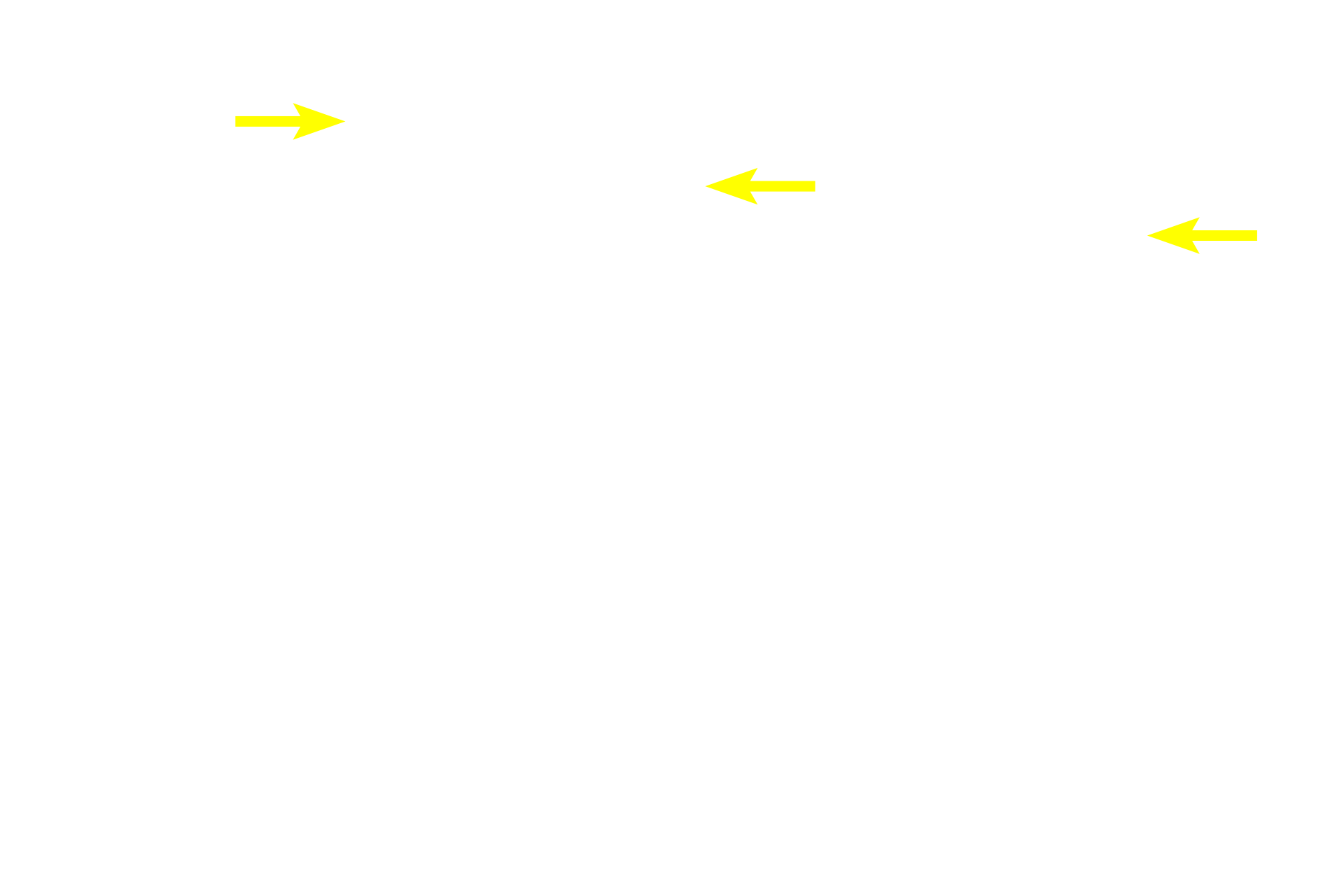  - Squamous cells <p>Stratified epithelia have multiple layers and are further classified by the shape of the cells at the surface.  In stratified squamous epithelia, cells flatten as they are pushed from basal to surface layers.  Surface cells are living, with visible nuclei.  A layer of keratin does not form and the epithelium remains moist.  Esophagus  400x</p>
