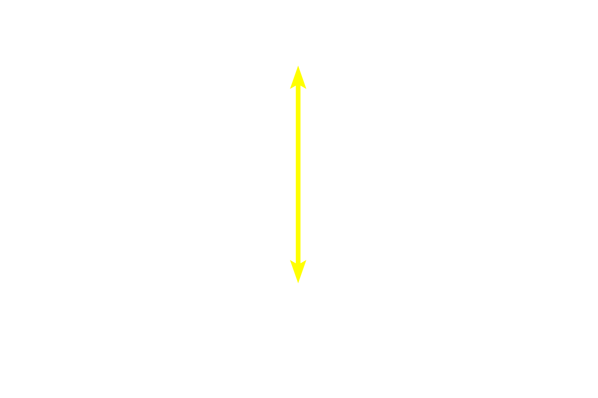 Transitional epithelium <p>Transitional epithelium, often called urinary epithelium, lines the urinary tract and, therefore, must undergo transitions between relaxation and distension.  Thus, this epithelium varies between stratified cuboidal and stratified squamous.  The dome-shaped cells at the surface of this stratified cuboidal epithelium are characteristic of the urinary bladder when it is not distended with urine.  1000x</p>
