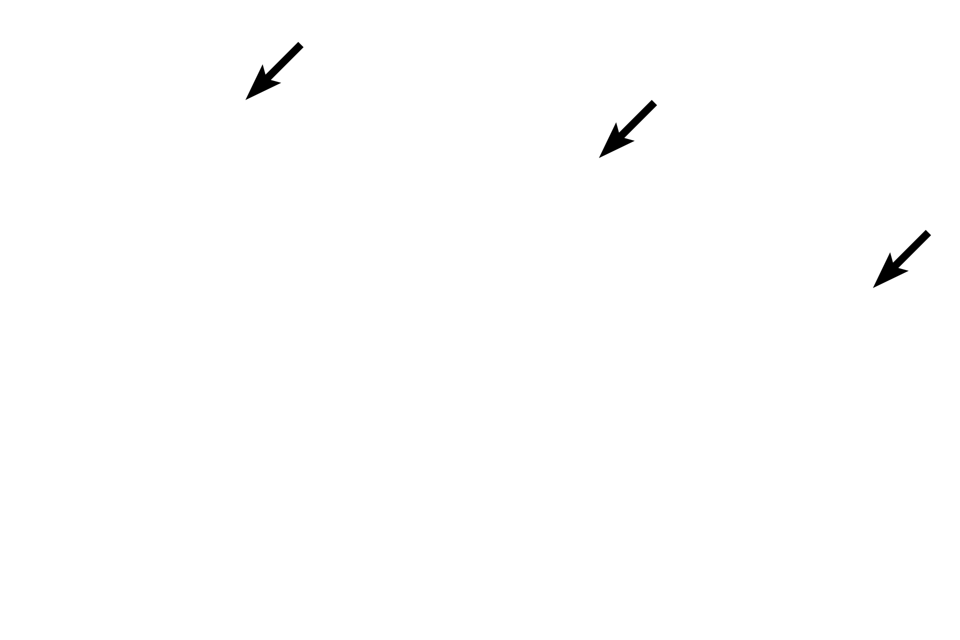  - Dome cells <p>Transitional epithelium, often called urinary epithelium, lines the urinary tract and, therefore, must undergo transitions between relaxation and distension.  Thus, this epithelium varies between stratified cuboidal and stratified squamous.  The dome-shaped cells at the surface of this stratified cuboidal epithelium are characteristic of the urinary bladder when it is not distended with urine.  1000x</p>
