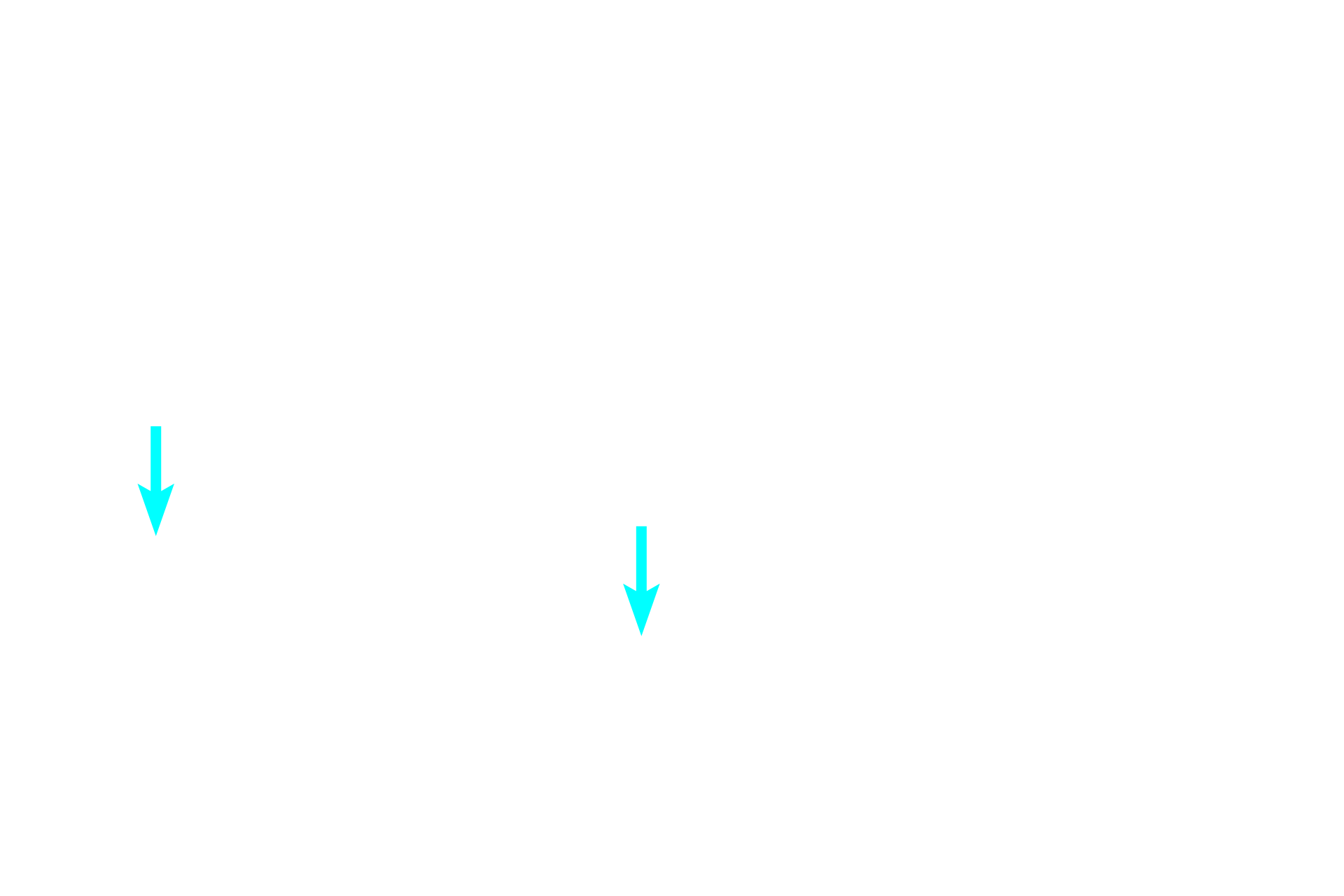 Basement membrane <p>Transitional epithelium, often called urinary epithelium, lines the urinary tract and, therefore, must undergo transitions between relaxation and distension.  Thus, this epithelium varies between stratified cuboidal and stratified squamous.  The dome-shaped cells at the surface of this stratified cuboidal epithelium are characteristic of the urinary bladder when it is not distended with urine.  1000x</p>
