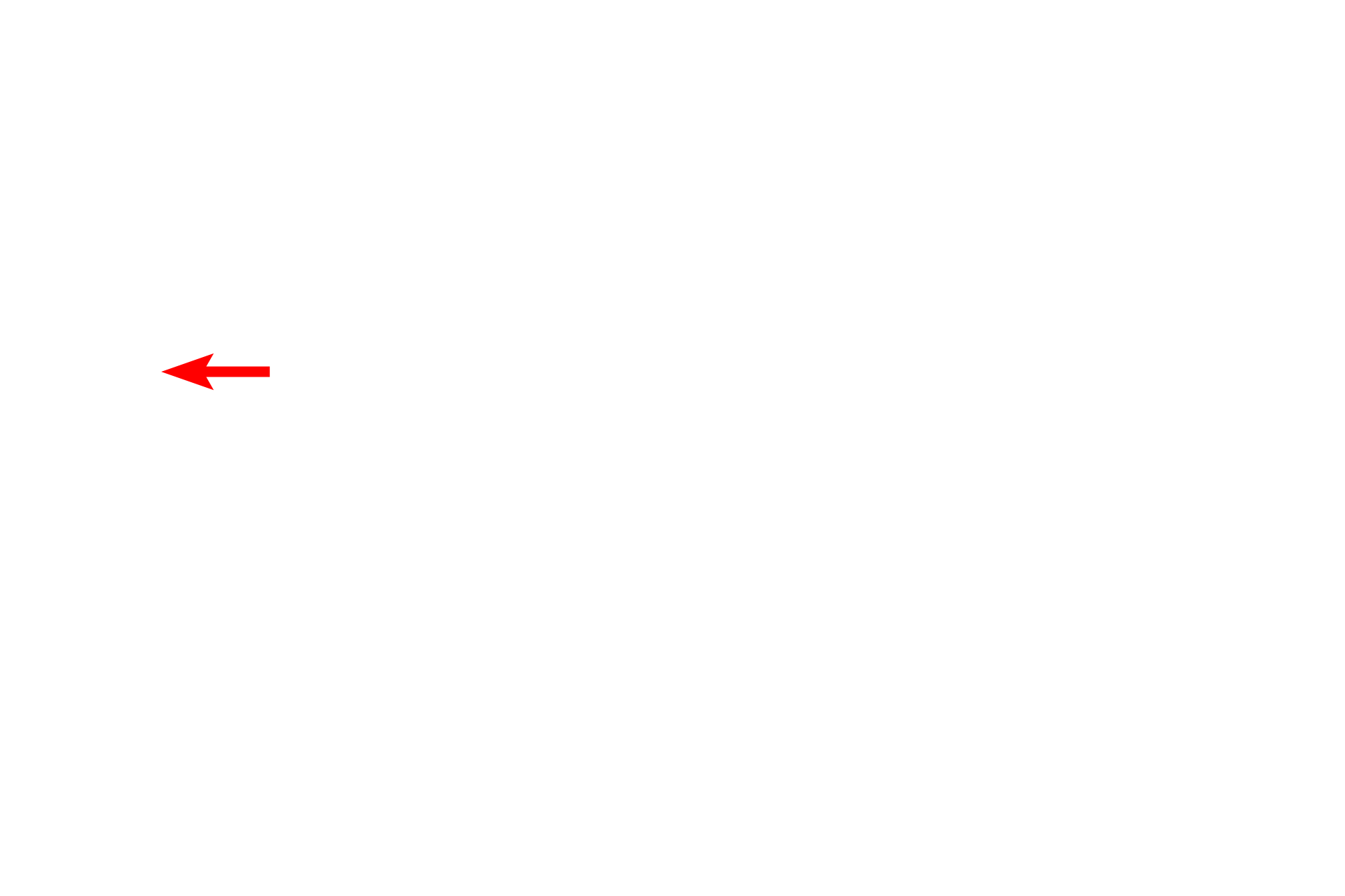 Continuous capillary > <p>Continuous capillaries are the most prevalent type. The endothelial cells form an uninterrupted tube surrounded by their basal laminae. Occluding (tight) junctions attach adjacent cells and a cytoplasmic fold may protrude at that site (arrow).</p>
