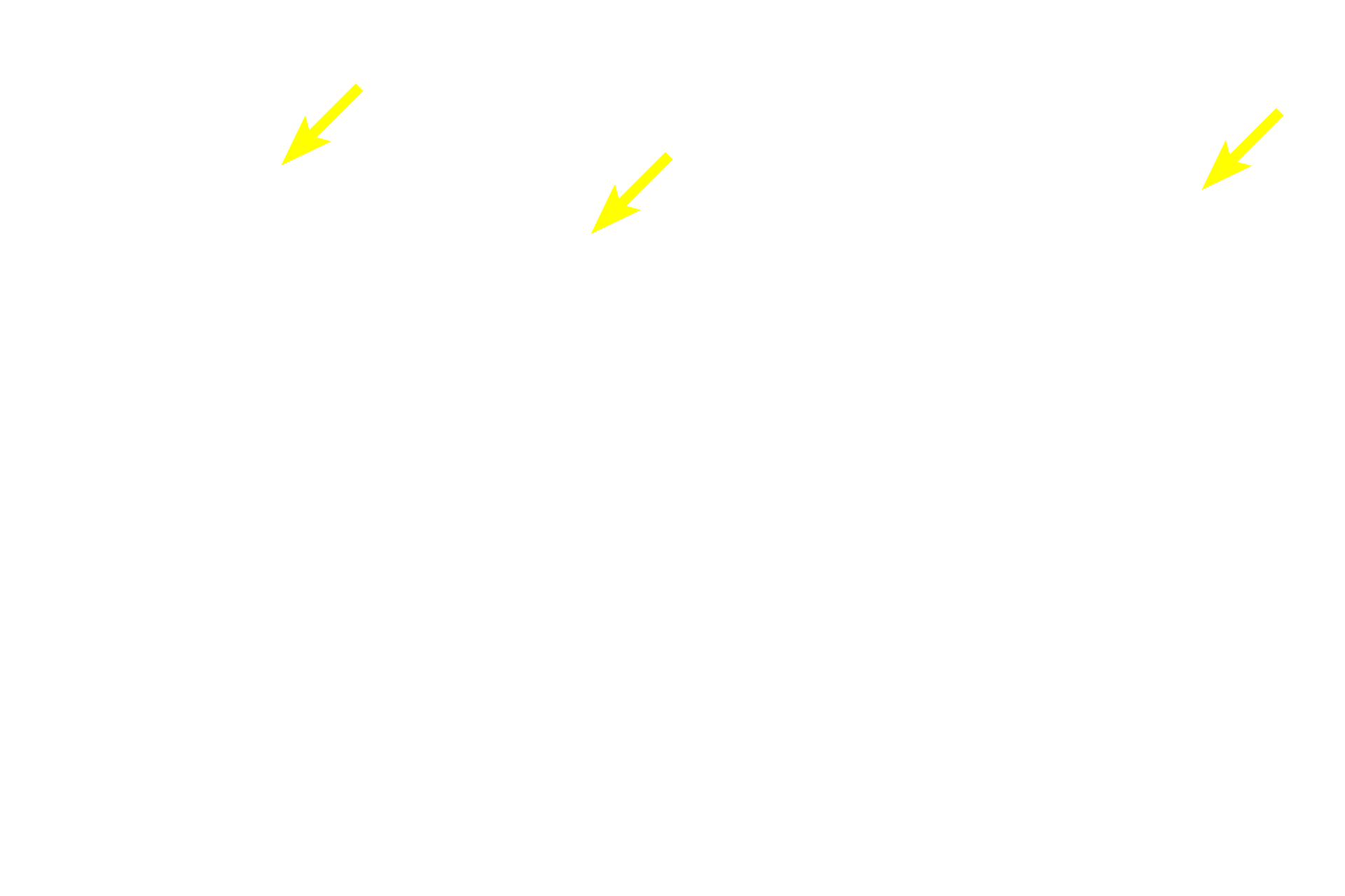 - Endothelium <p>The tunica media of veins is more heterogeneous than that of arteries, as seen by the mixture of smooth muscle and connective tissue in this vessel. Part of the tunica adventitia, the thickest layer of veins, has been removed in this preparation. 800x</p>