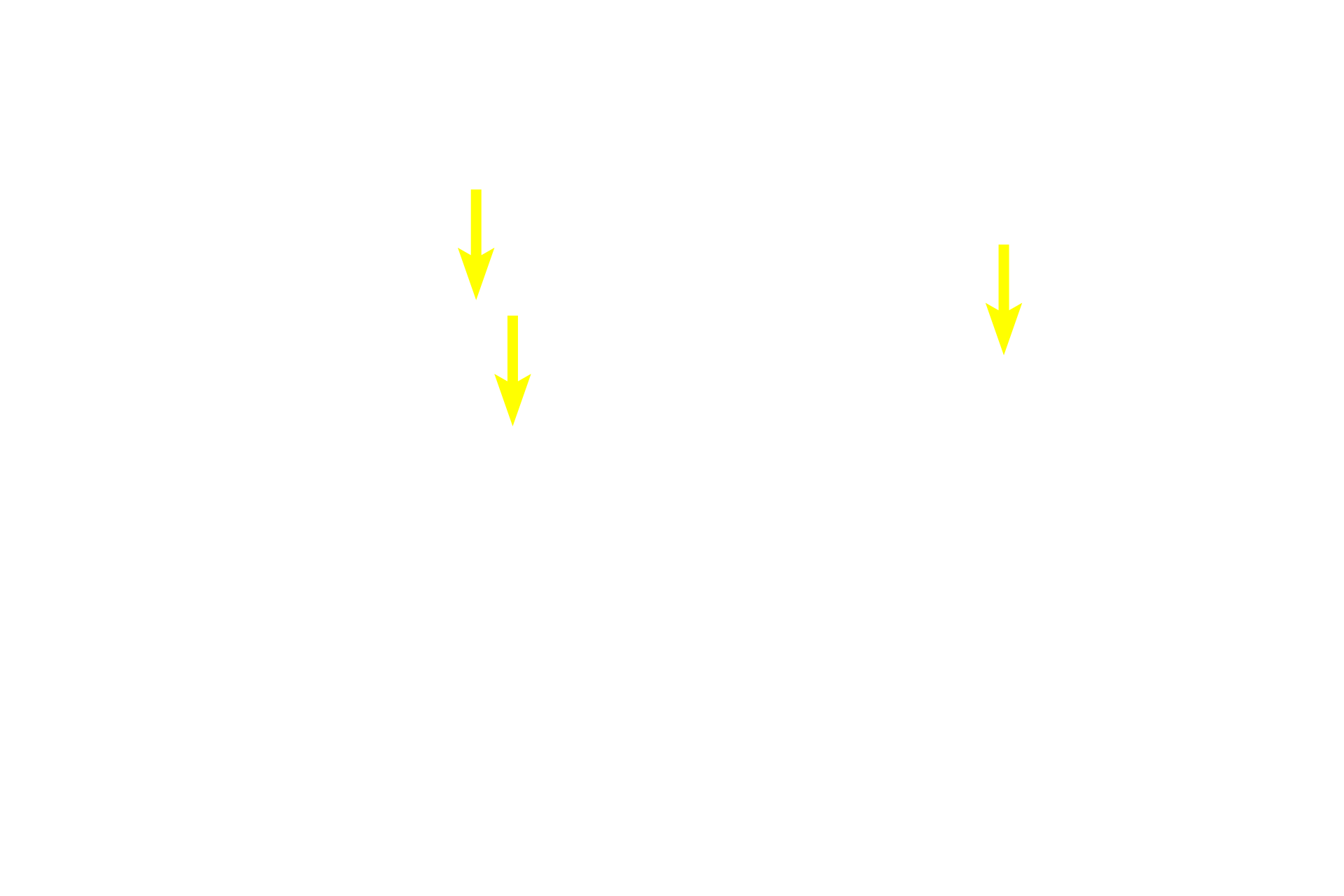 - Smooth muscle cells <p>The tunica media of veins is more heterogeneous than that of arteries, as seen by the mixture of smooth muscle and connective tissue in this vessel. Part of the tunica adventitia, the thickest layer of veins, has been removed in this preparation. 800x</p>