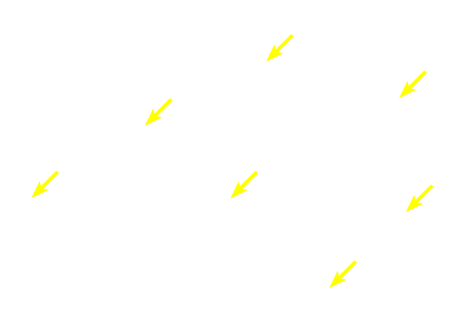 Connective tissue <p>The walls of large veins show great heterogeneity. Here, tunica intima is composed of endothelium and a CT layer that contains longitudinally orientated smooth muscle. A discontinuous internal elastic lamina is present. Tunica media is composed of circularly arranged smooth muscle (cut in cross section in this longitudinal section), interspersed with CT. 400x</p>