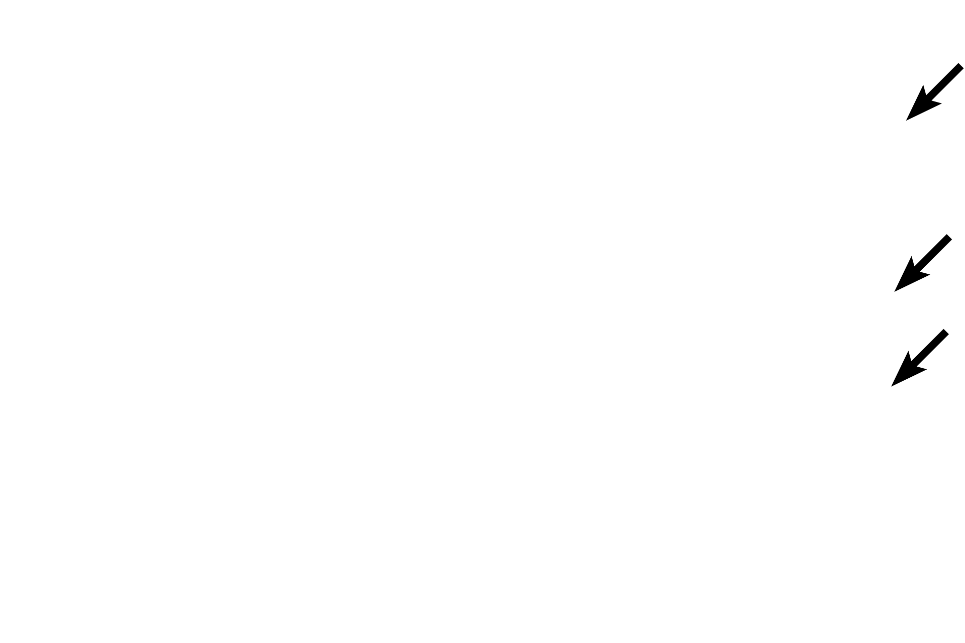 - Endothelium <p>The walls of large veins show great heterogeneity. Here, tunica intima is composed of endothelium and a CT layer that contains longitudinally orientated smooth muscle. A discontinuous internal elastic lamina is present. Tunica media is composed of circularly arranged smooth muscle (cut in cross section in this longitudinal section), interspersed with CT. 400x</p>