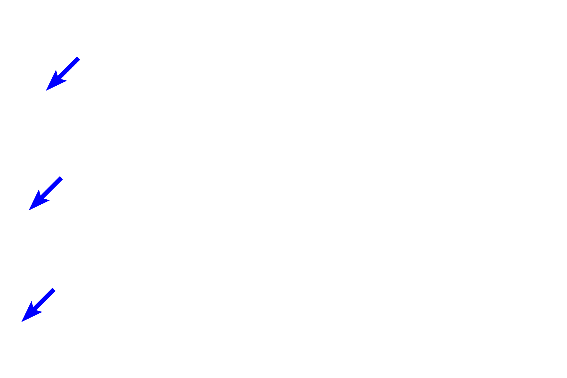 Capsule <p>A higher magnification image of the adrenal shows both the cortex, surrounded by the dense connective tissue capsule, and the medulla.  The adrenal cortex, source of the adrenal steroid hormones, is divided into a zona glomerulosa beneath the capsule, followed by the zona fasciculata and zona reticularis.  200x</p>
