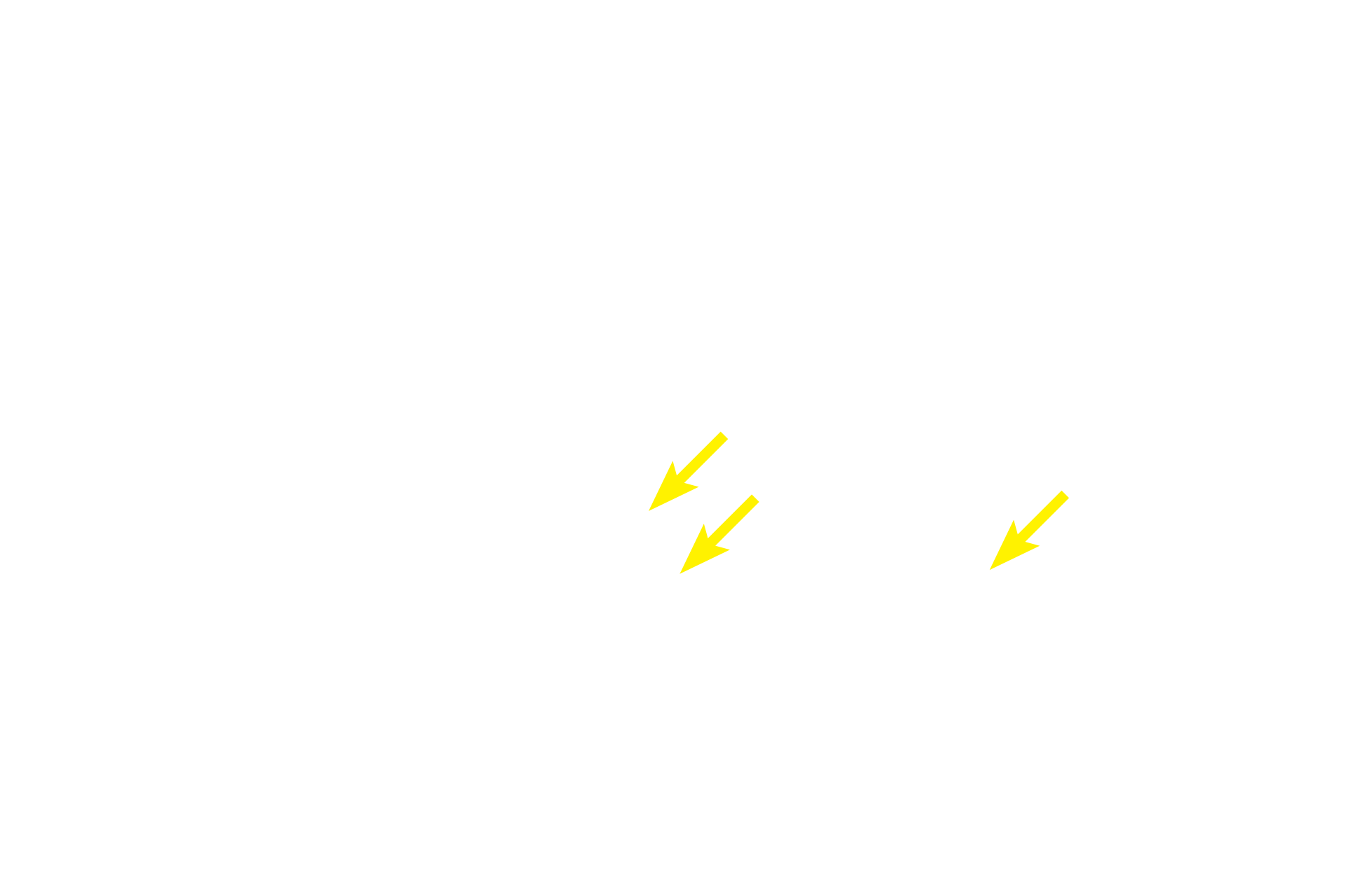  - Secretory granules <p>Enteroendocrine cells, seen here in the intestinal glands of the small intestines, secrete their hormones into the connective tissue of the surrounding lamina propria.  Therefore, the secretory granules in these cells are located adjacent to the basement membrane of the glands. Paneth cells are exocrine cells and their secretory granules lie adjacent to the lumen of the gland, into which they secrete.  1000x</p>
