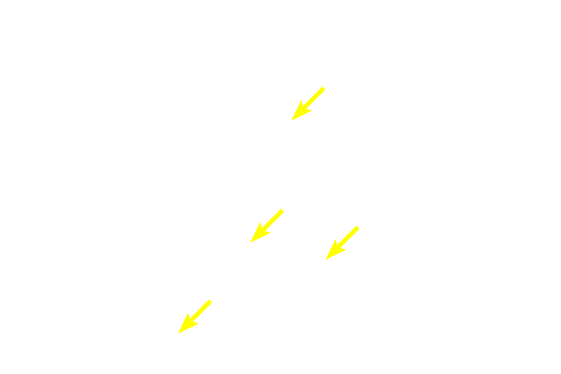 Peptide-secreting cells > <p>Peptides form one major classification of hormones.  Peptide-secreting cells possess all the organelles needed to produce proteins for export:  RER, Golgi apparatus, and secretory granules.  Therefore, these cells stain intensely and appear grainy when seen with the light microscope.</p>
