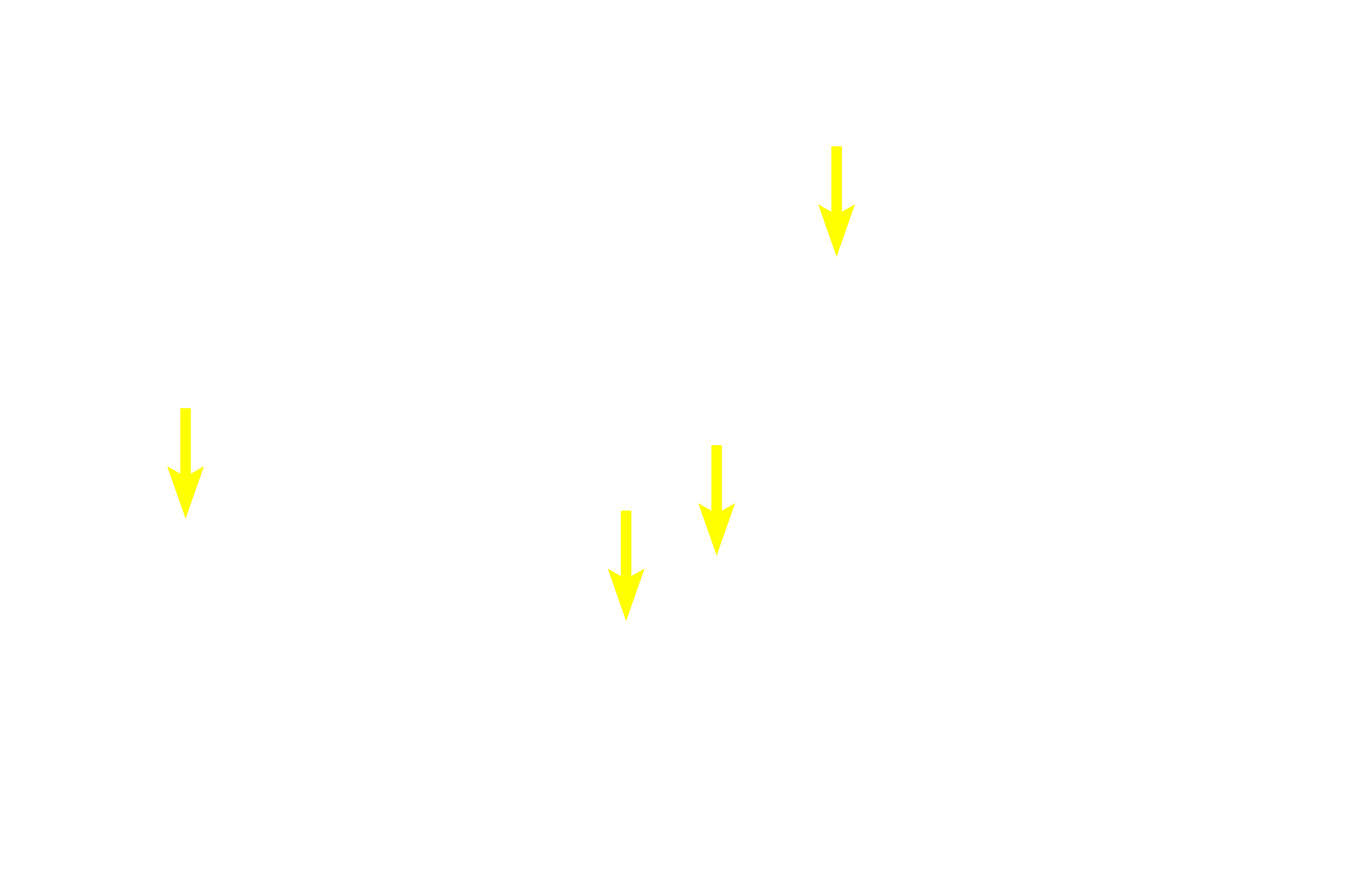  - Golgi apparatus > <p>The Golgi apparatus is responsible for packaging the secretory protein into vesicles.  The Golgi appears as an unstained area of the cytoplasm adjacent to the nucleus in these cells.</p>
