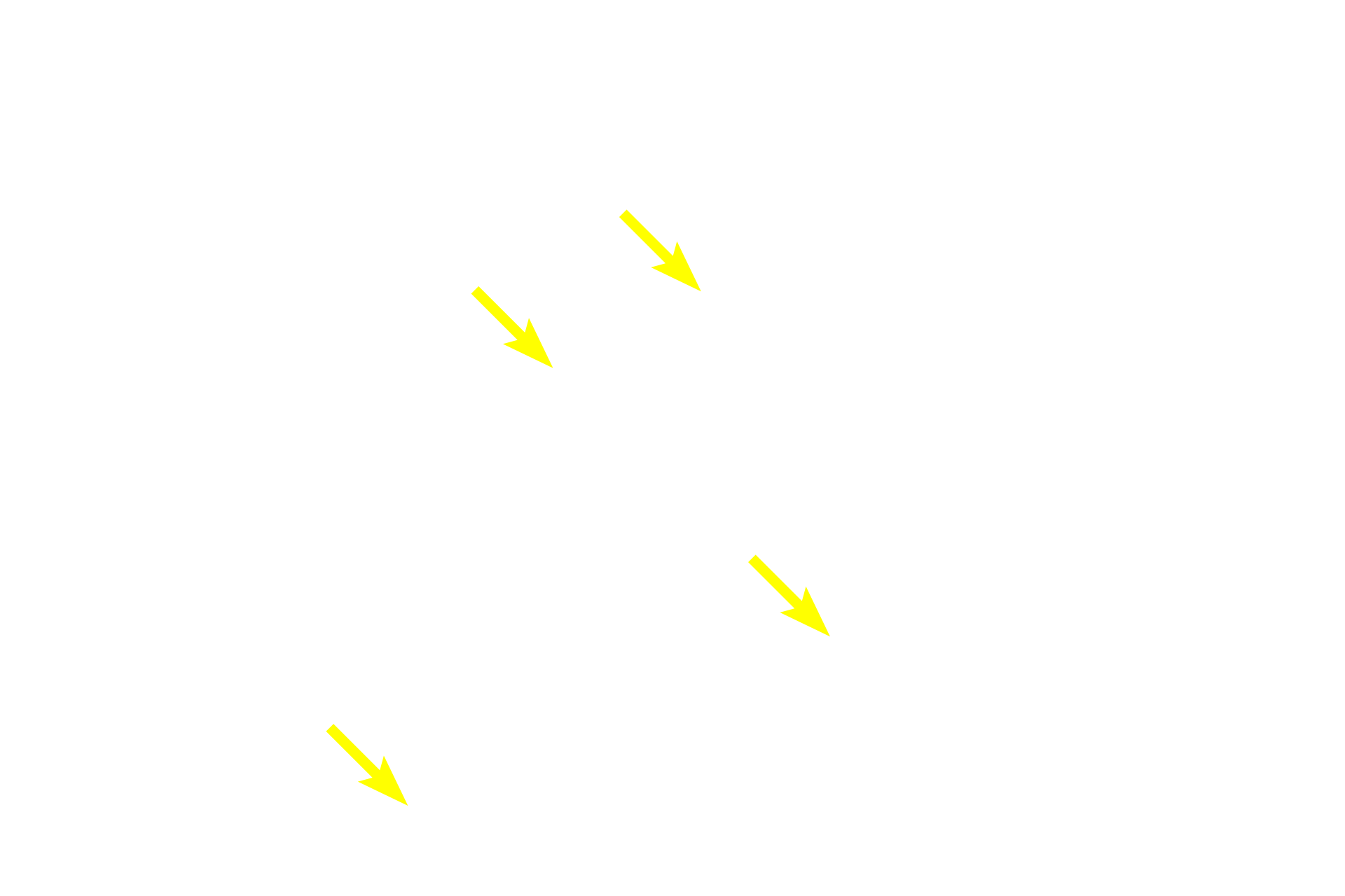  - Secretory granules > <p>The content of the secretory granules will cause them to stain differentially.  In this image, some cells contain granules that stain with hematoxylin; in other cells, the granules stain with eosin.  Secretory granules may be positioned around the entire circumference of the cell, thus validating the lack of polarity in endocrine cells.</p>
