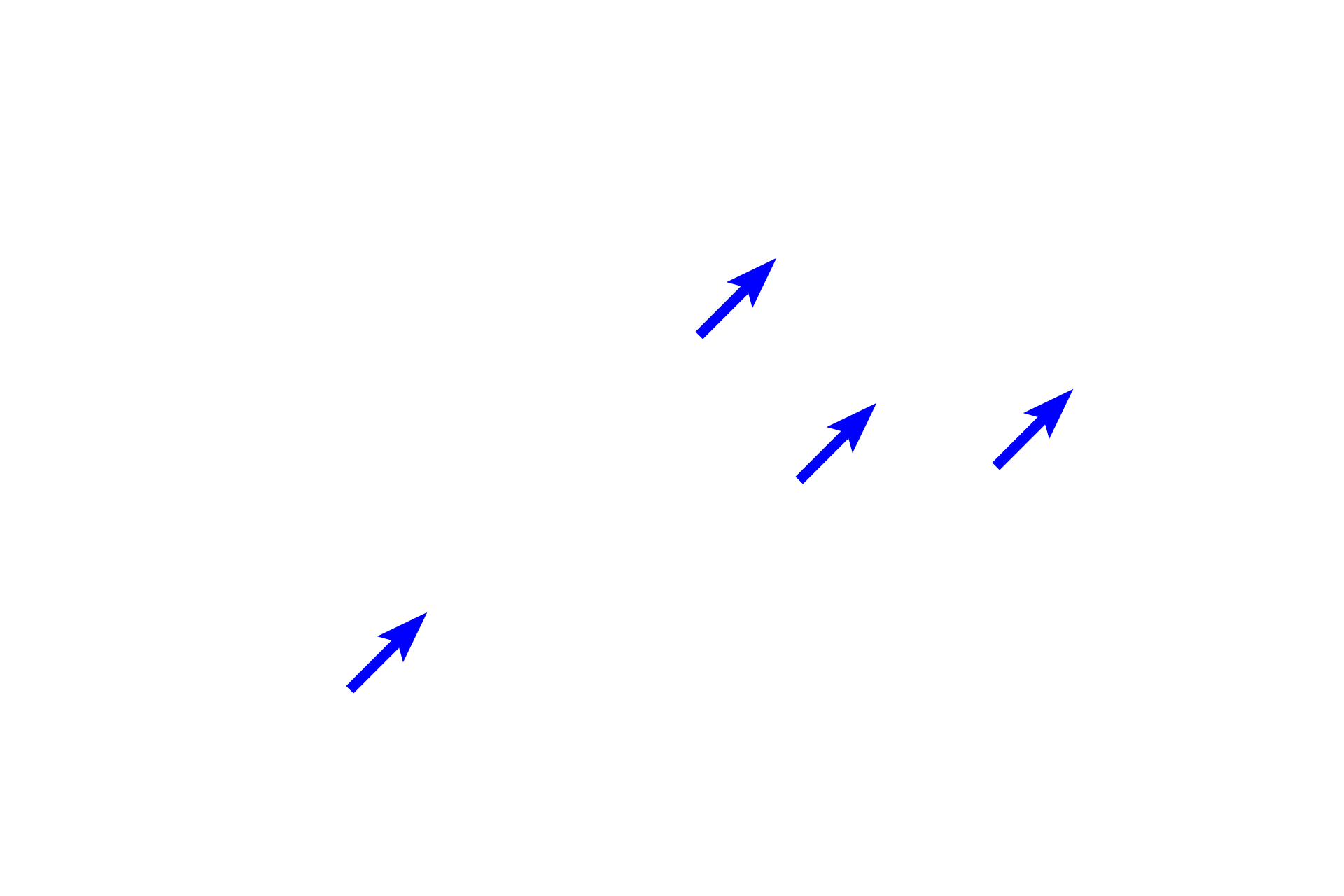 Herring bodies with hormone-containing granules <p>The main hormones released from the pars nervosa are oxytocin and vasopressin, actually synthesized by paraventricular and supraoptic neurons located in the hypothalamus.  Hormone-containing granules are transported down the axons of these neurons and accumulate in their expanded terminals called Herring bodies.  Pituicytes surround Herring bodies and assist hormone storage and release.  1000x</p>
