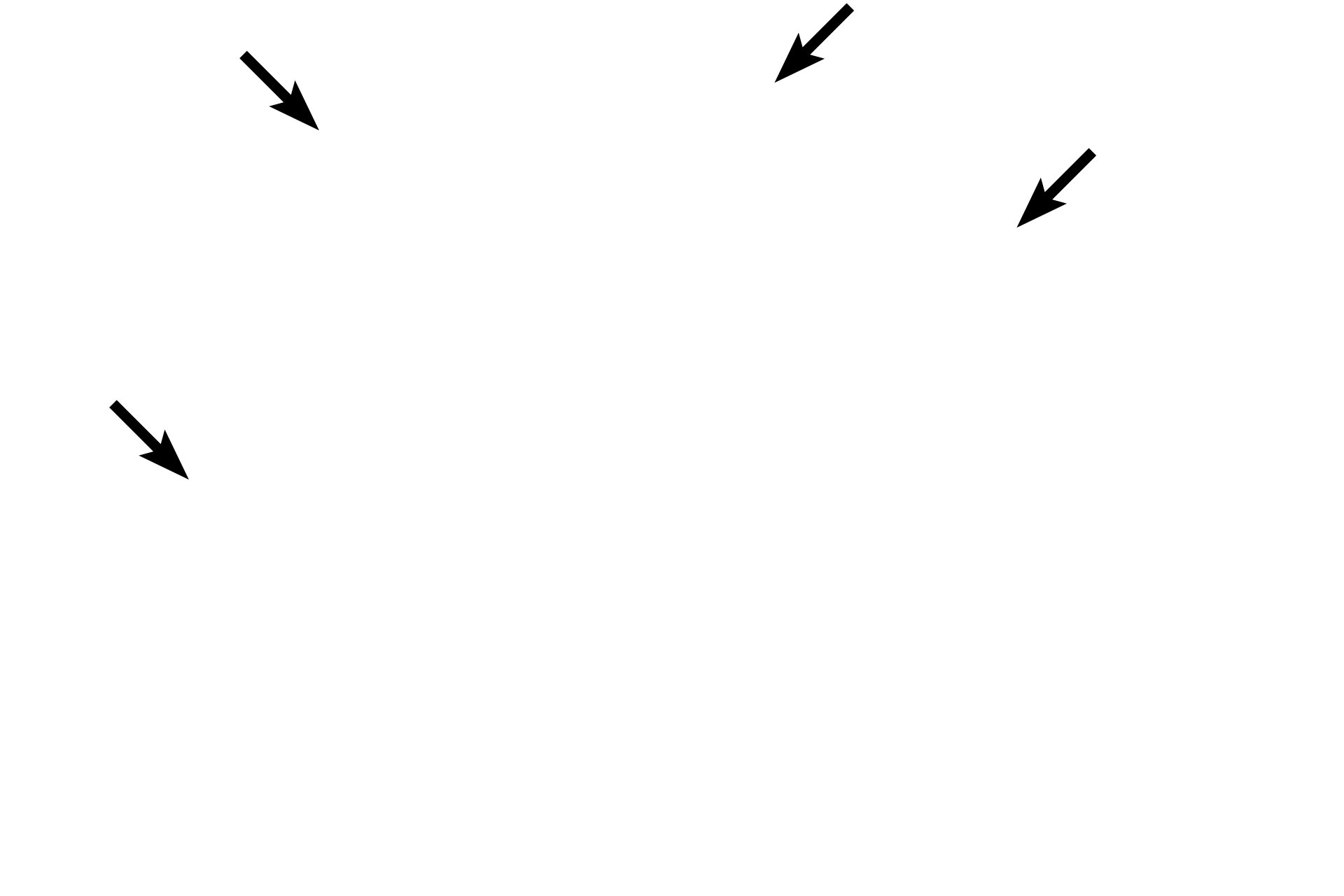 Capsule <p>This image shows a horizontal section through the human pituitary at a level just below the infundibulum. The contrast between the pale-staining neural tissue and the deeply basophilic staining of the glandular adenohypophyseal tissue is evident. The entire pituitary is surrounded by a dense connective tissue capsule that is continuous with the dura mater. 10x</p>