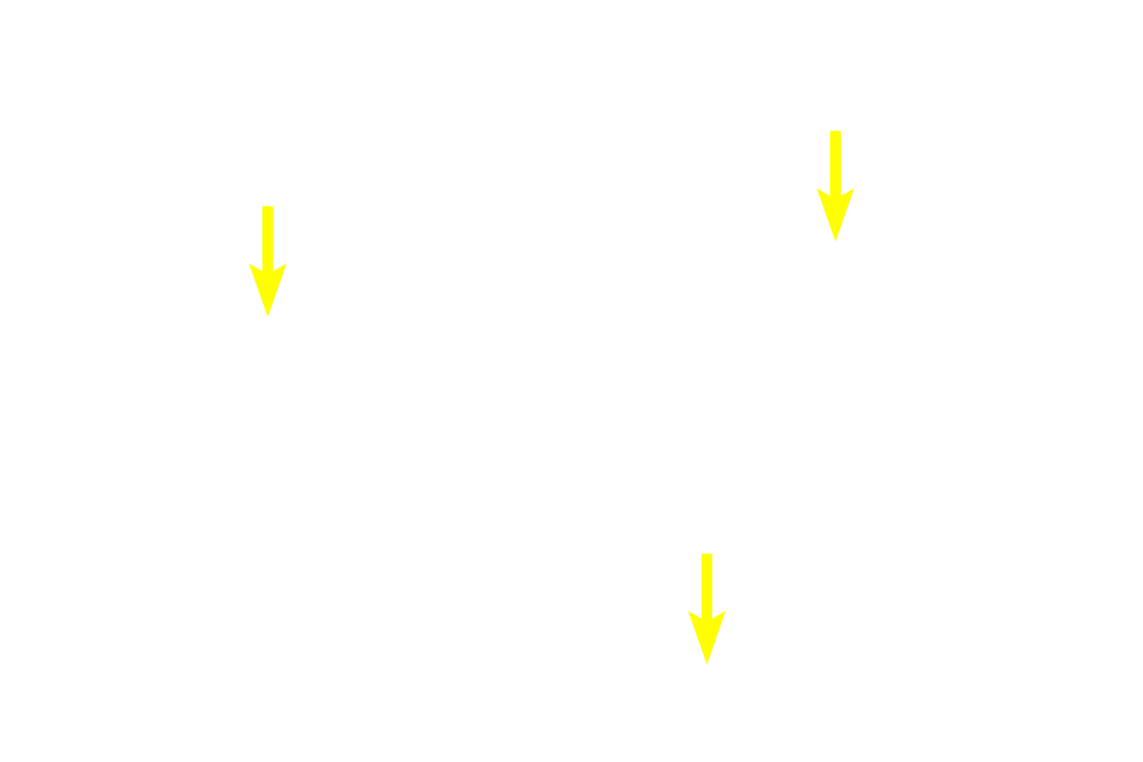 Location of Golgi body > <p>The large Golgi apparatus present in these cells displaces the secretory granules, leaving a pale region.  The Golgi is responsible for assembling and packaging the secretory granules.</p>
