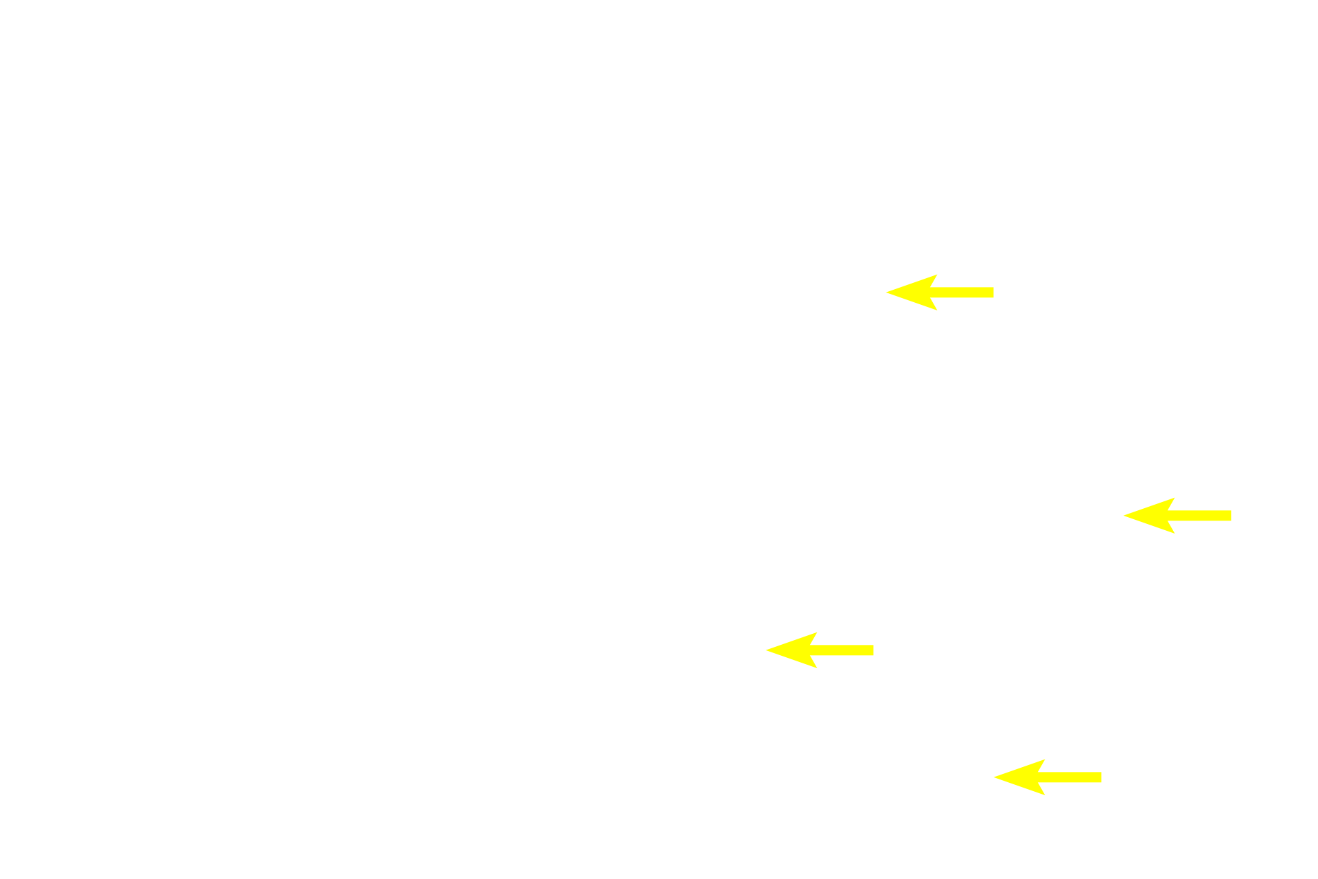 Sinusoids > <p>Sinusoids are large diameter, thin walled capillaries (discontinuous capillaries). After maturing in the hemopoietic tissue, red and white blood cells migrate into the sinusoids for dispersal throughout the body.</p>
