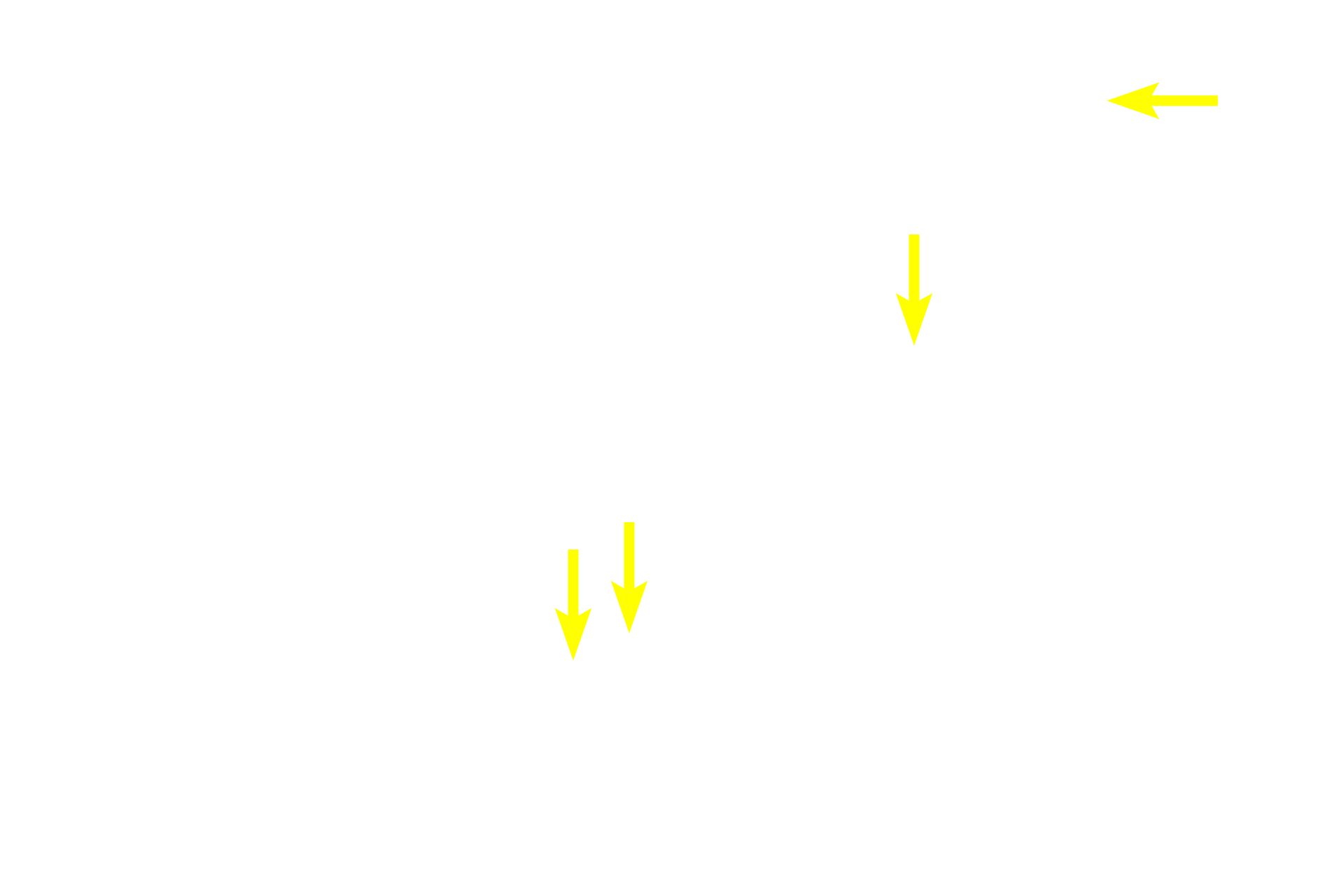 Secretory product <p>Apocrine sweat glands are located in the axillary, areolar and anal regions.  Contrary to their name, they secrete a thick, protein-rich secretion by the merocrine mode.  These secretions acquire a distinctive odor by the action of bacteria on the skin surface.  The duct of an apocrine sweat gland empties into the hair follicle.  400x</p>
