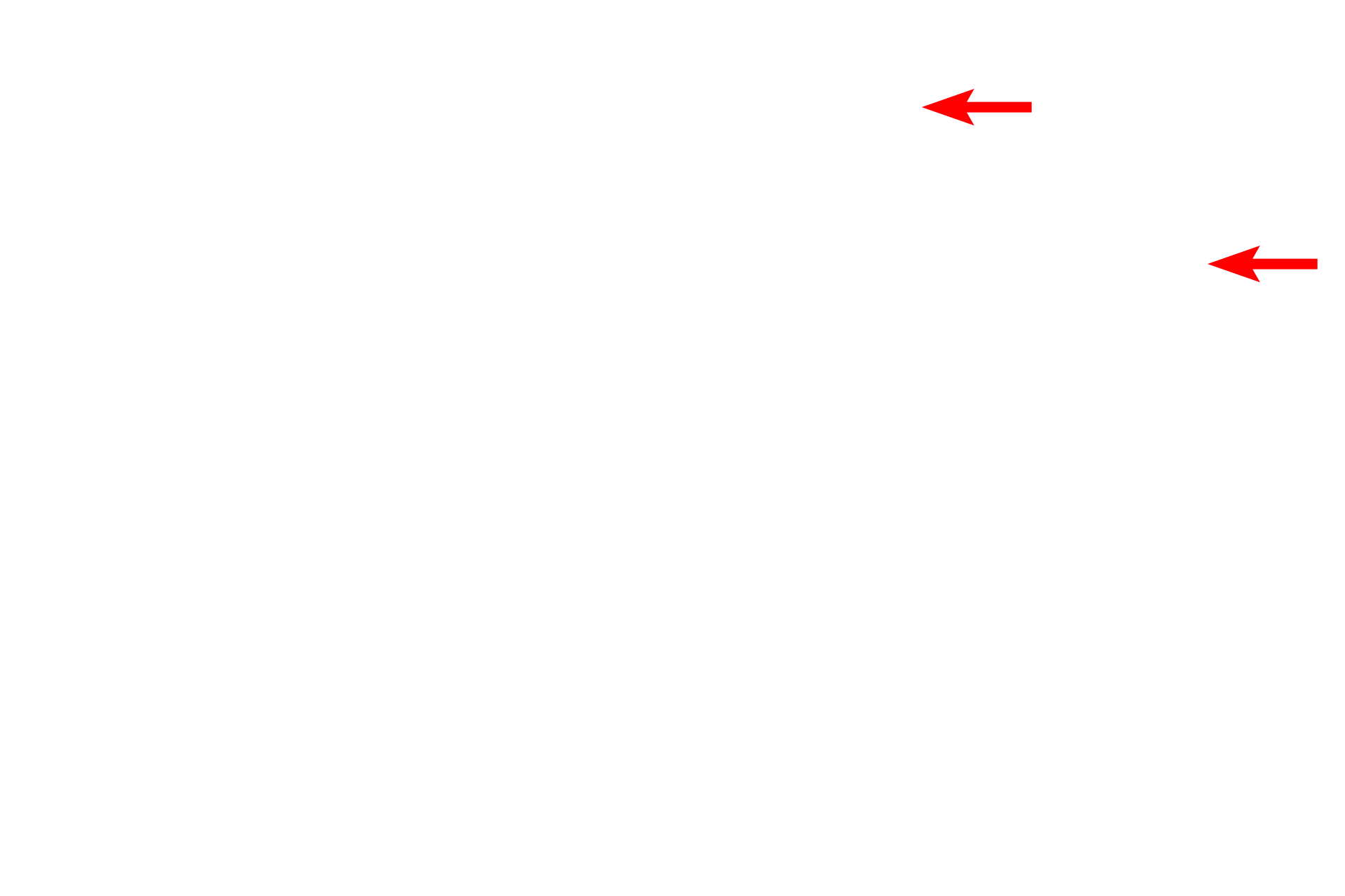 - Stratum granulosum <p>The epidermis is a stratified squamous keratinized epithelium composed mostly of keratinocytes arranged in multiple strata. Keratinocytes undergo an apoptosis-like process, producing a cornified layer at the surface. This epithelium is specialized to provide protection against physical trauma and desiccation, and presents a barrier to infectious agents. 1000x</p>