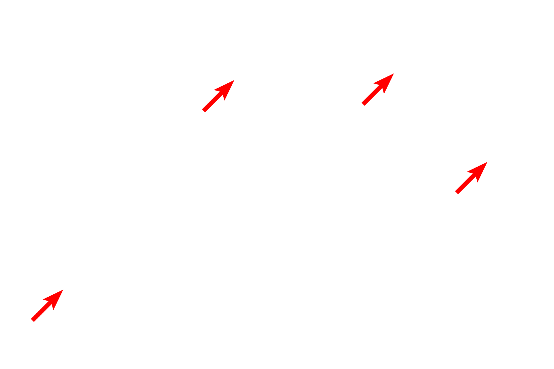  - Melanosomes <p>Pale-staining melanocytes contain melanosomes distributed throughout the cell. Melanosomes, containing the pigment melanin, are transferred into the neighboring keratinocytes. Tonofibrils, composed of keratin intermediate filaments (tonofilaments), can be seen in the keratinocytes of stratum basale.  15,000x</p>
